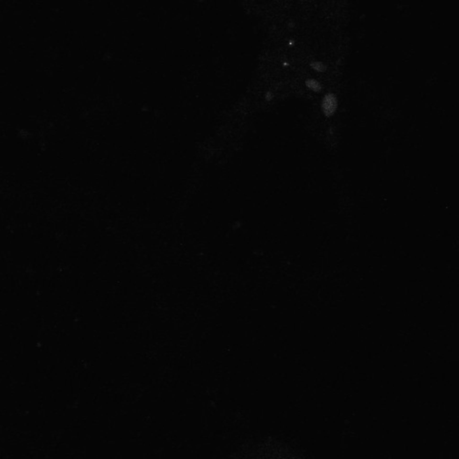 Xenopus laevis (Axon) - CIL:36998