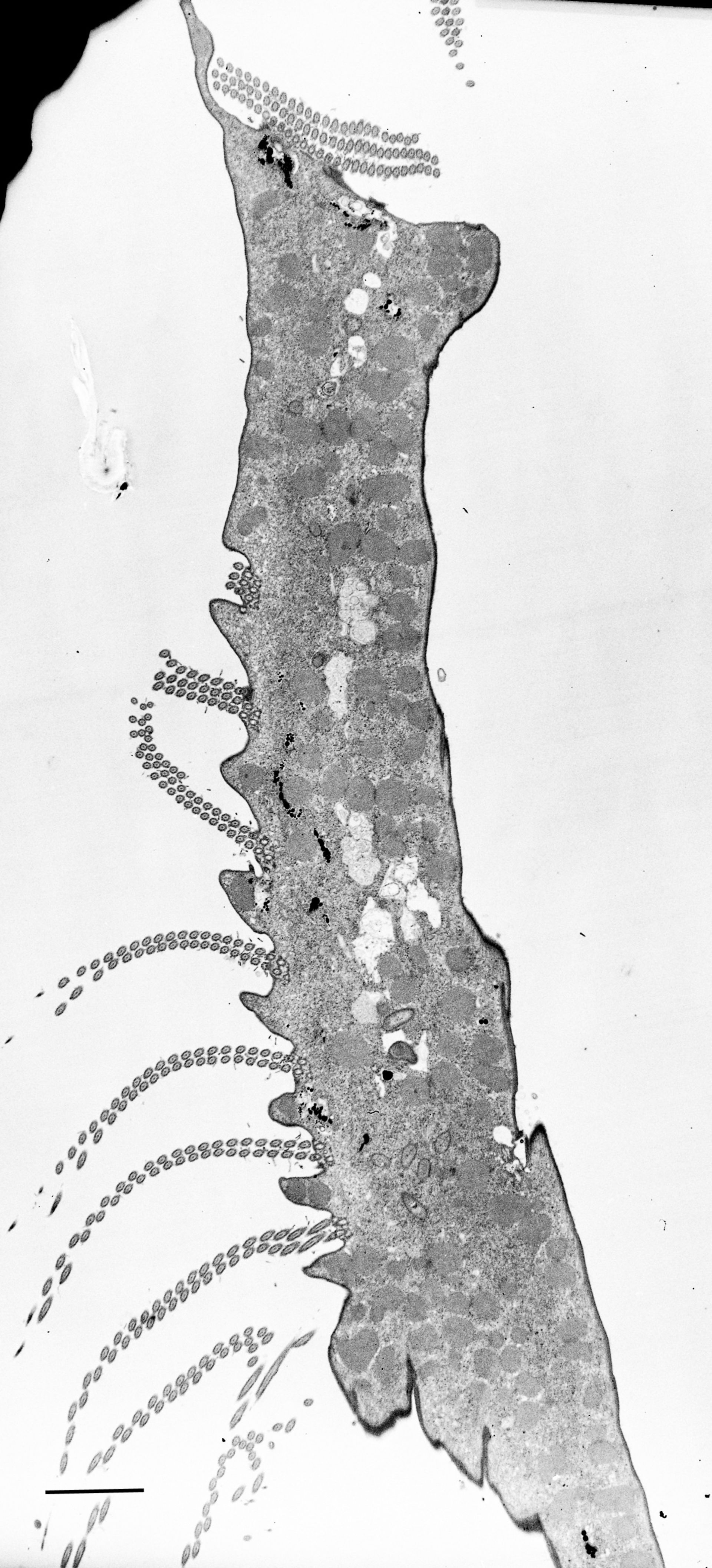 Euplotes sp. (Cytoplasm) - CIL:12337