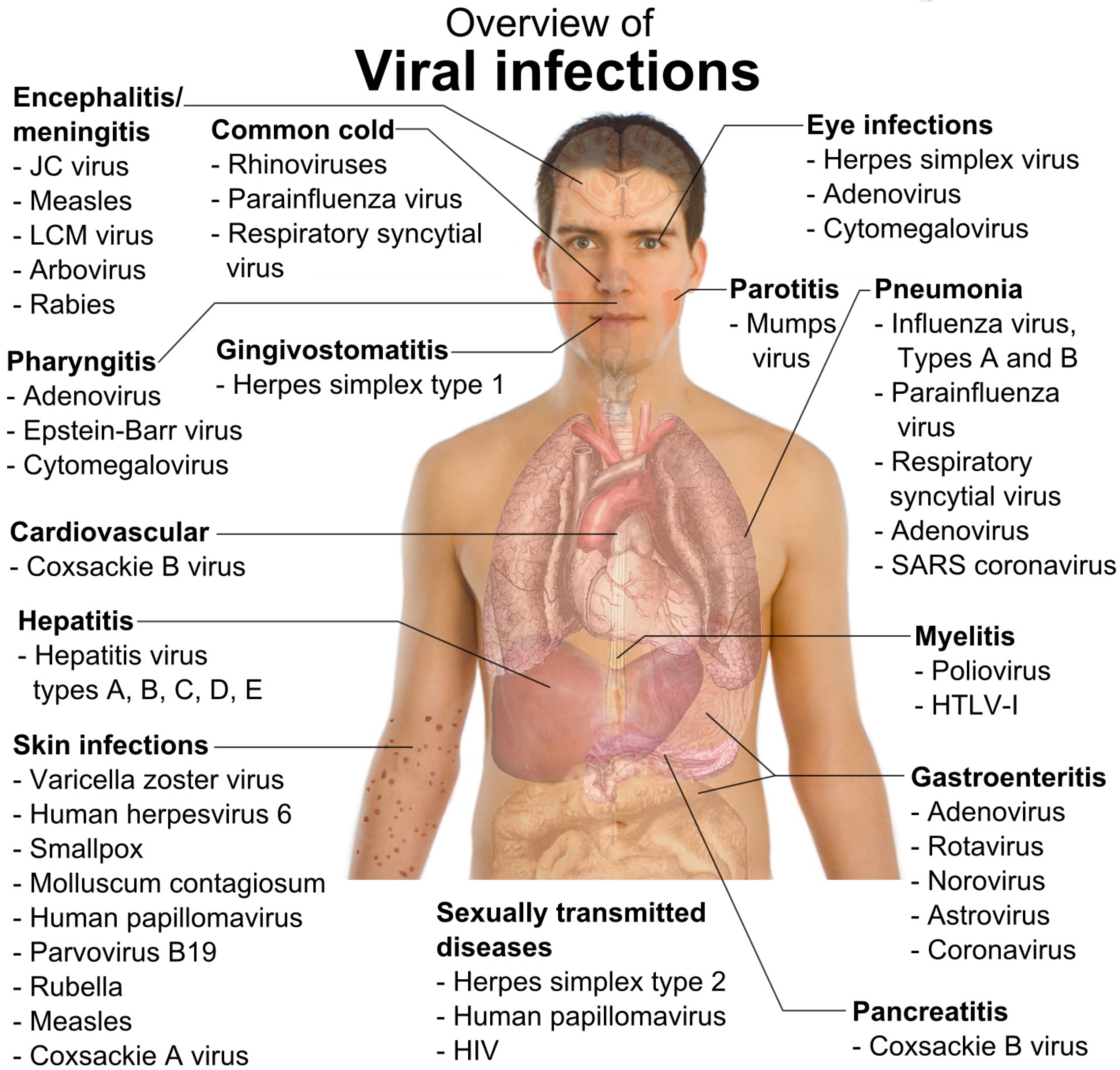 Virale Infektionen (Schema)