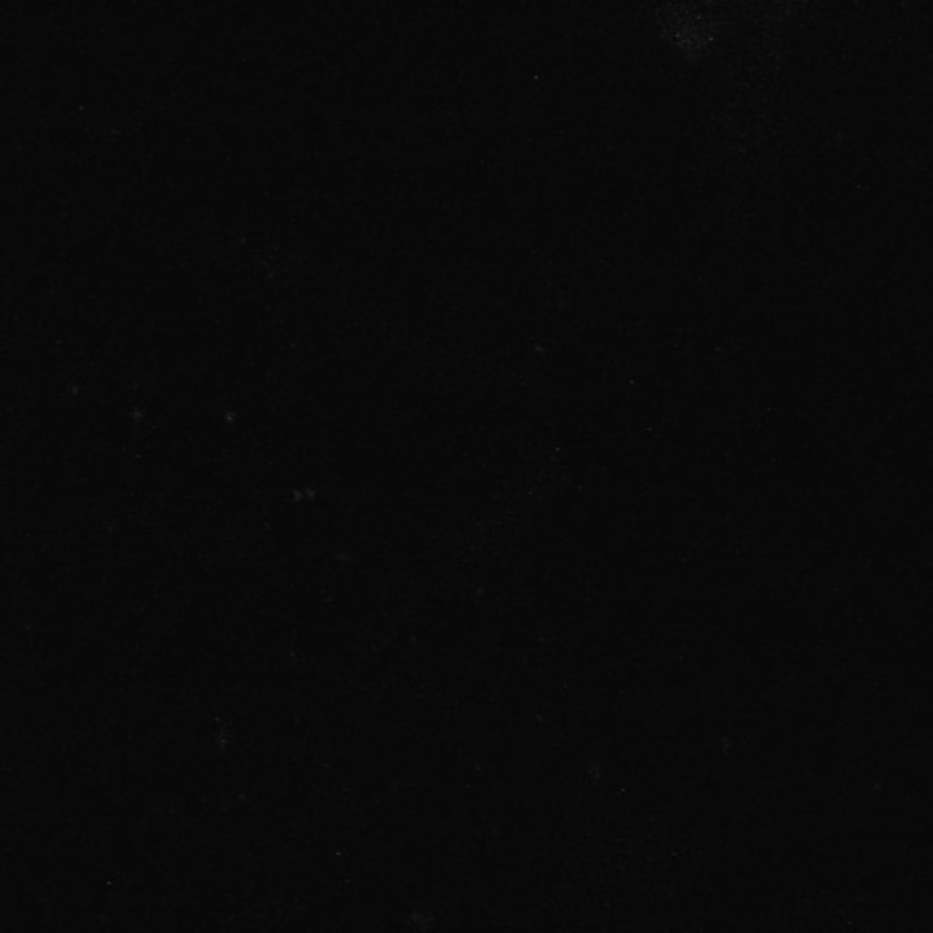 Xenopus laevis (Neuronal cell body) - CIL:37022