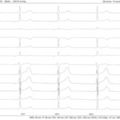 P Welle Doccheck Flexikon