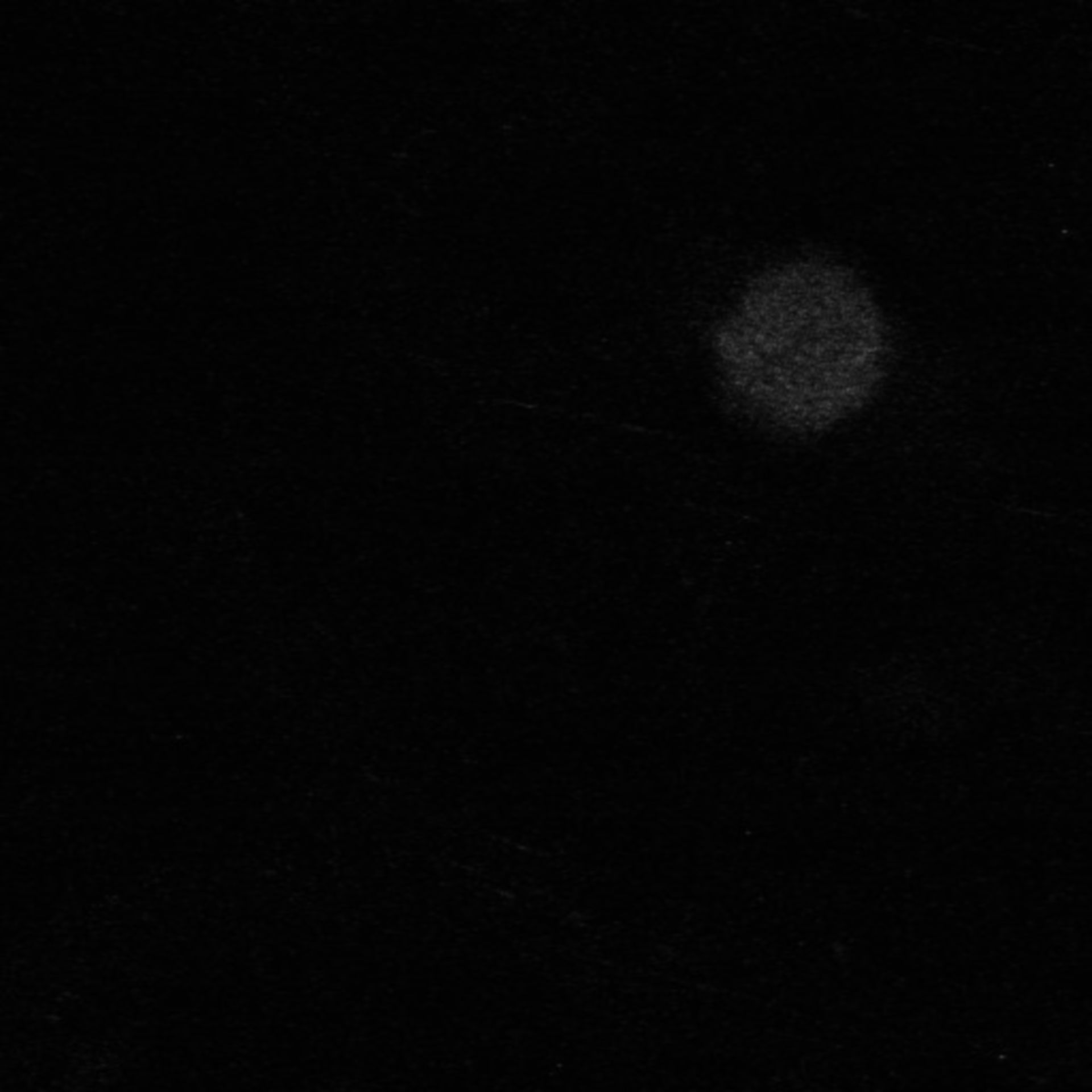 Xenopus laevis (Neuronal cell body) - CIL:37086