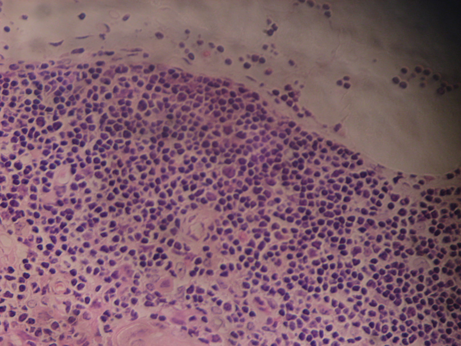 Thymus des Schafes 5 - Rindenausschnitt mit T- Zellen und Thymusepithelzellen