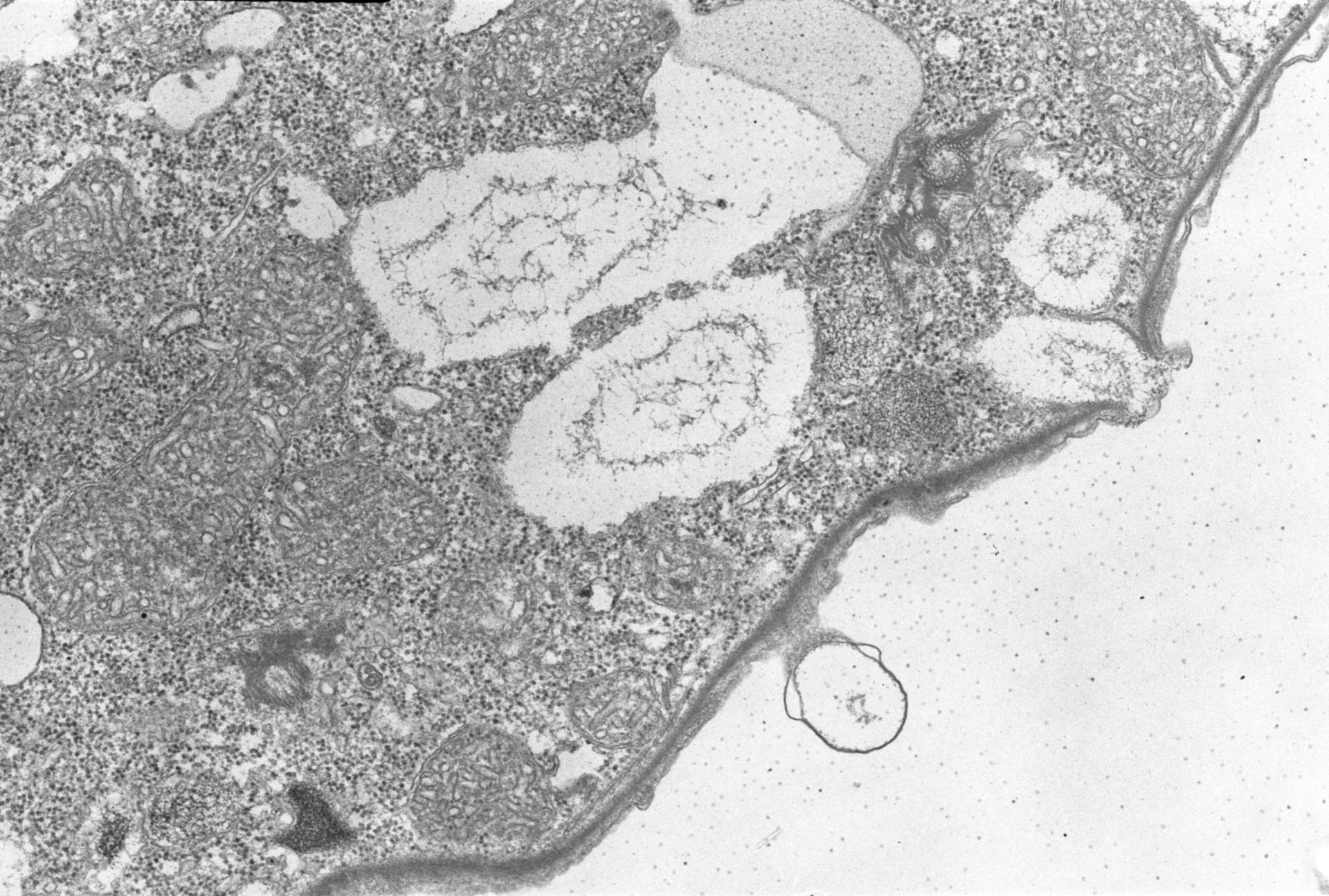 Colpoda cucullus (Cell cortex) - CIL:2861