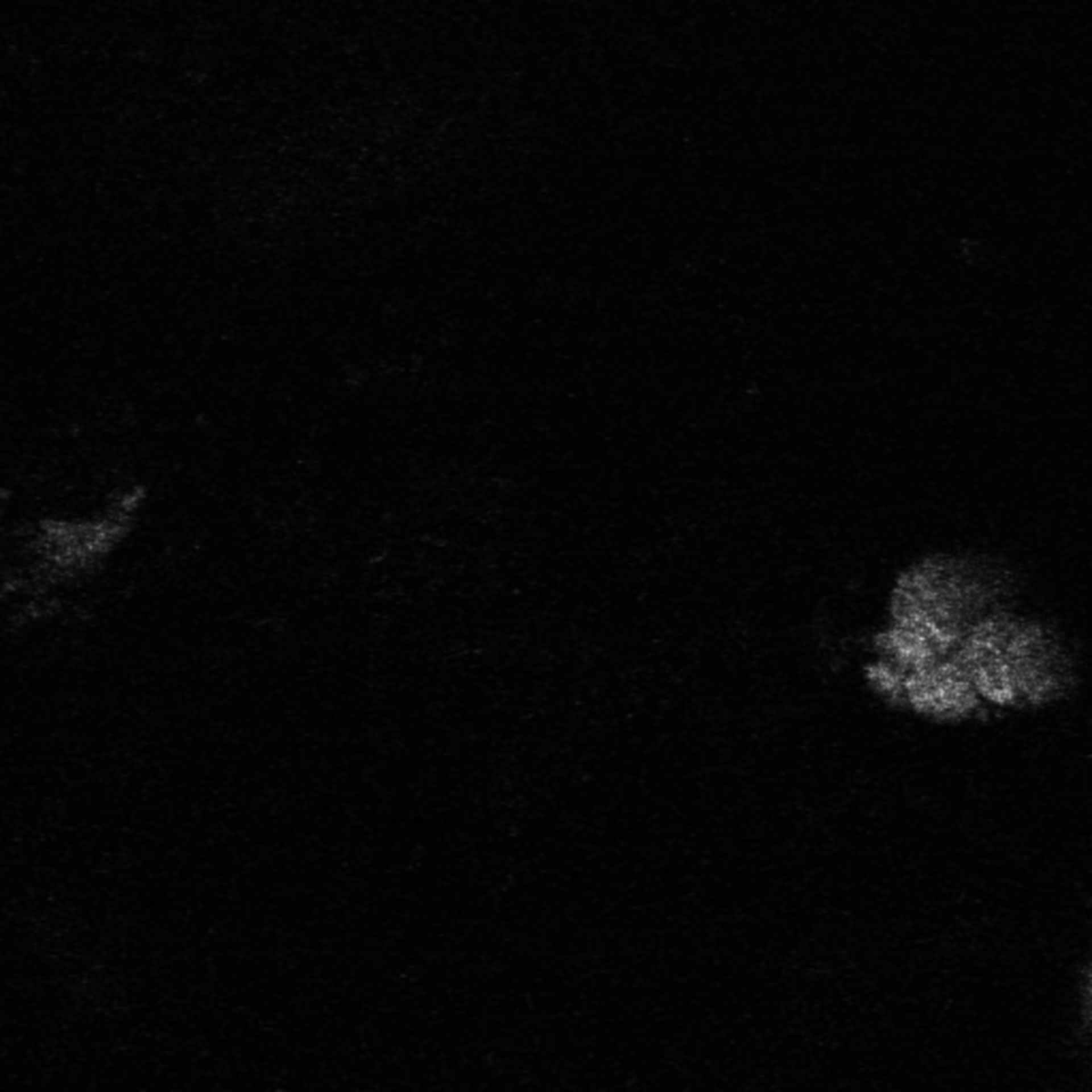 Xenopus laevis (Axon) - CIL:37044
