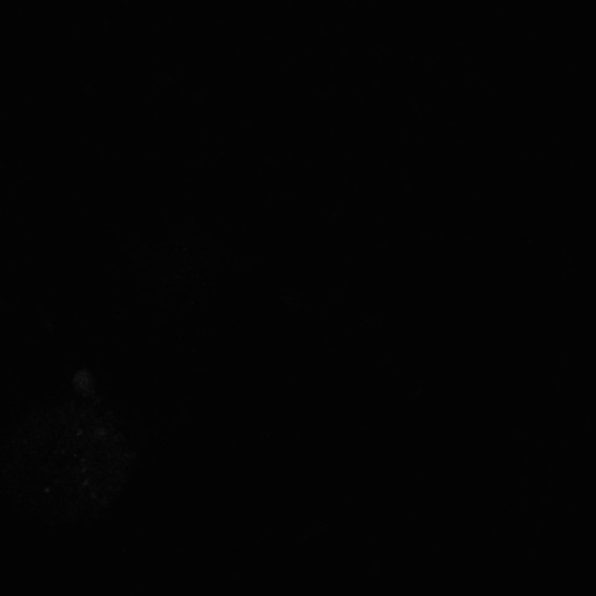 Xenopus laevis (Neuronal cell body) - CIL:36955