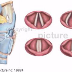 Stimmband Doccheck Flexikon