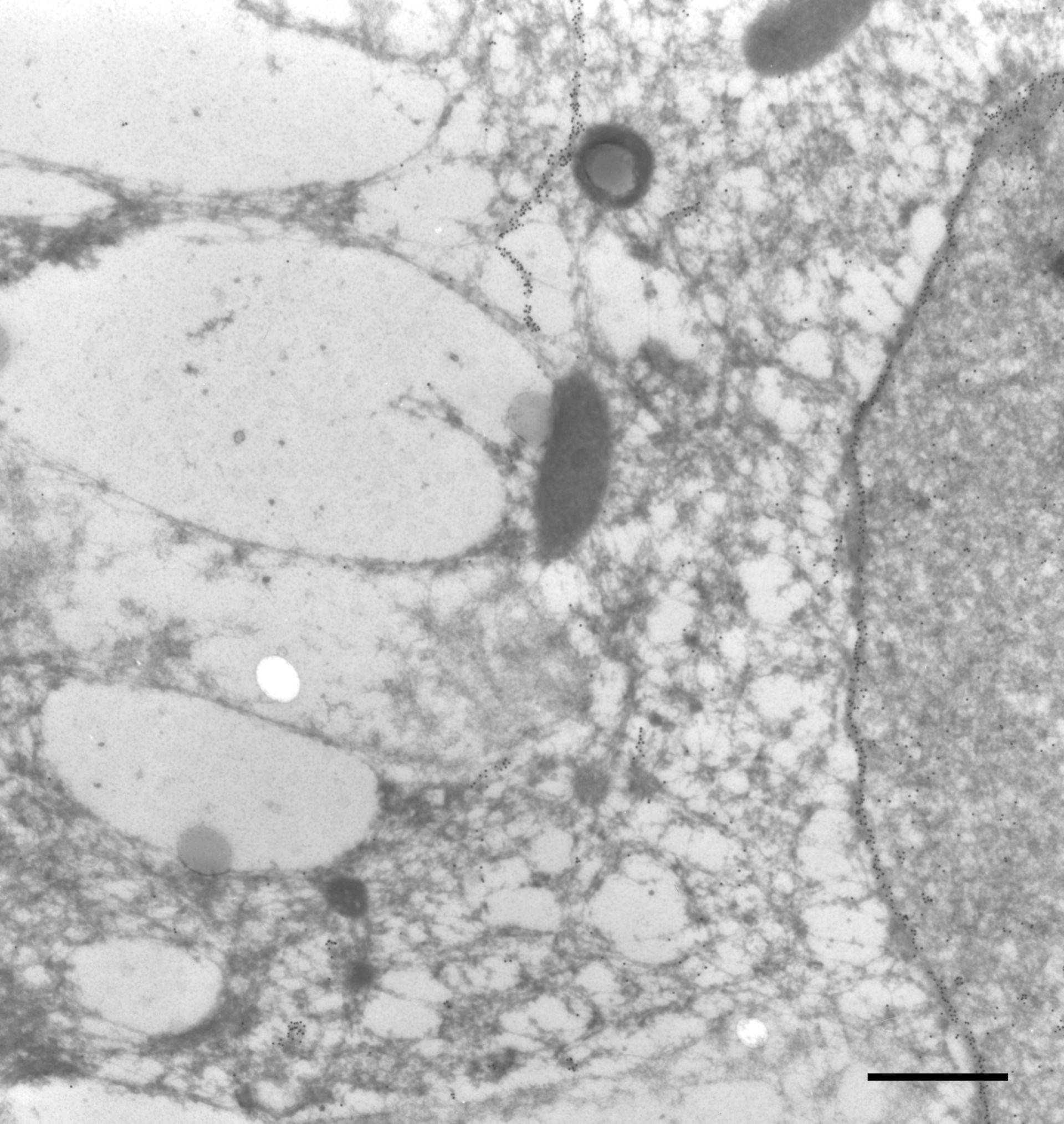 Paramecium tetraurelia (B-tubulin) - CIL:9856