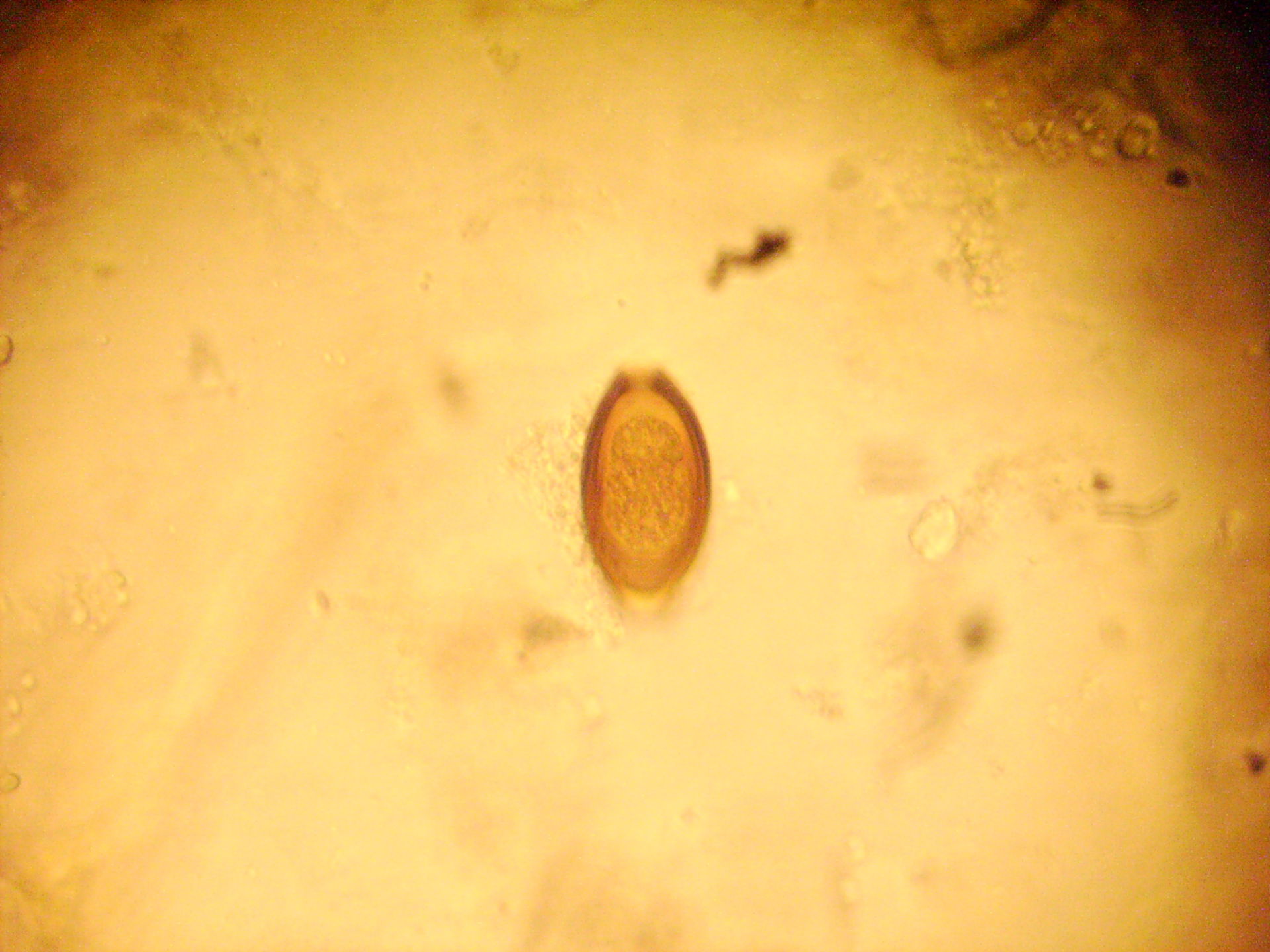 trichiuris trichiura c.