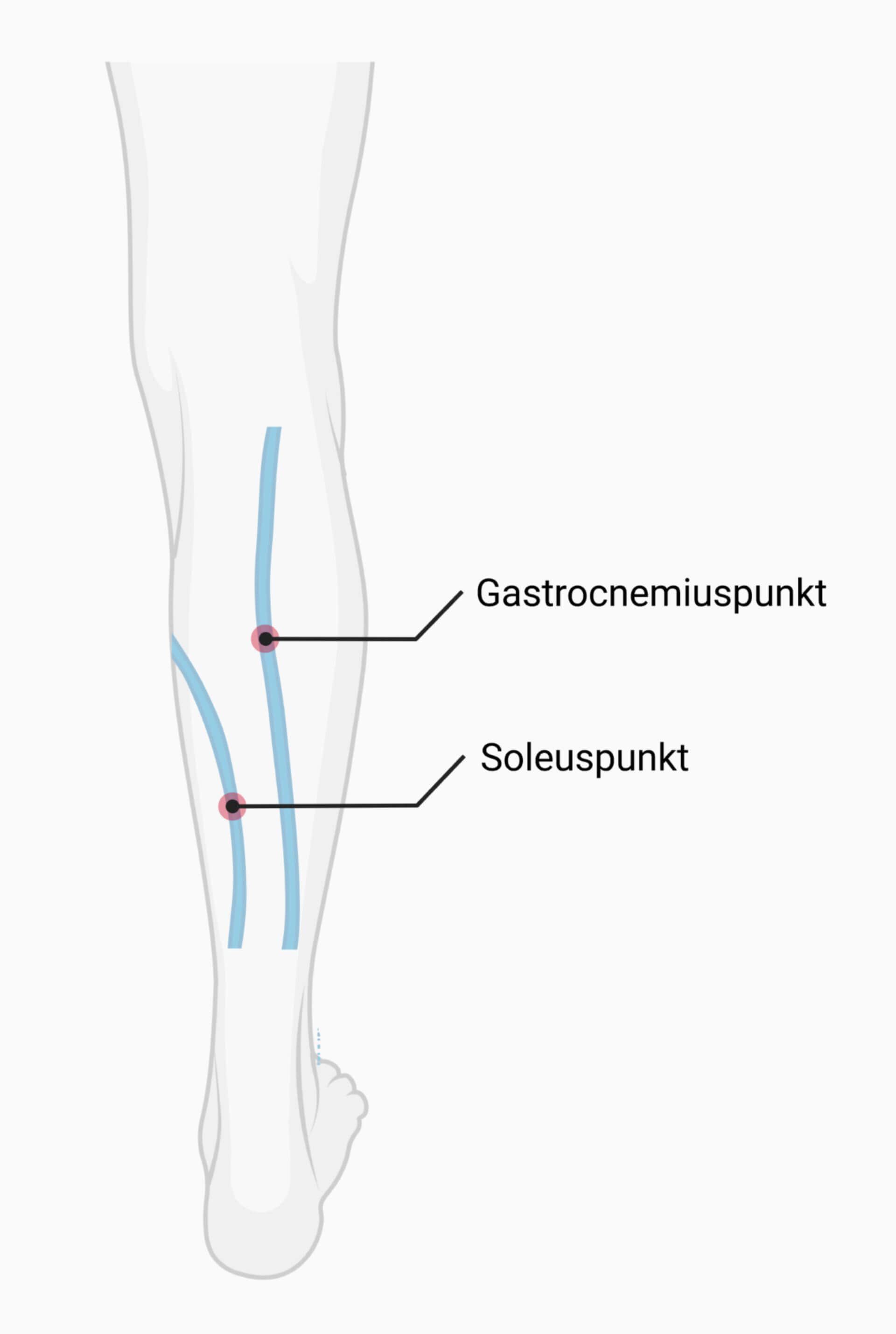 Gastrocnemiuspunkt und Soleuspunkt