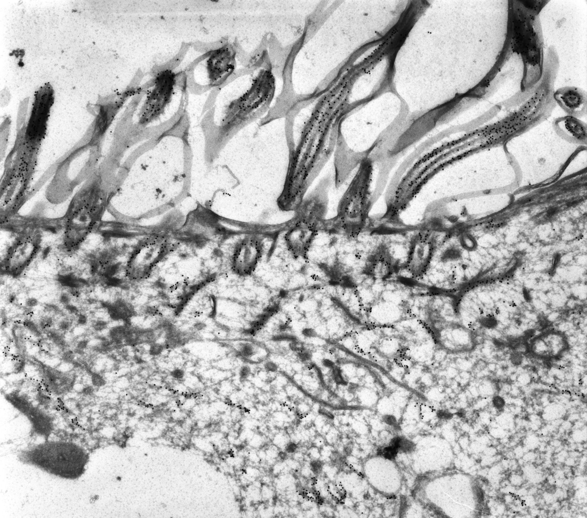 Paramecium tetraurelia (Microtubule basal body) - CIL:12081