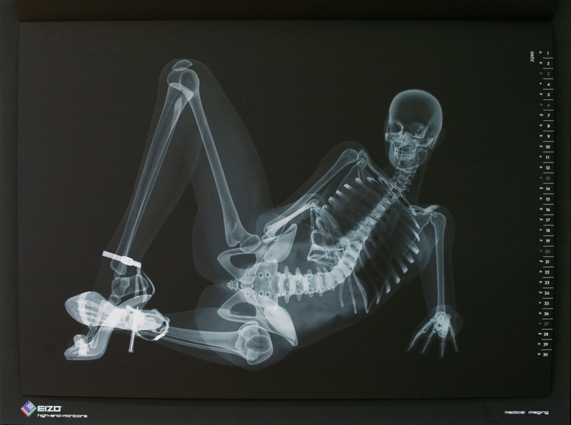 Diagnosis of radiographs