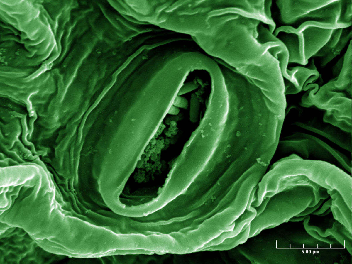 Escherichia coli-Bakterien auf Salat (REM)