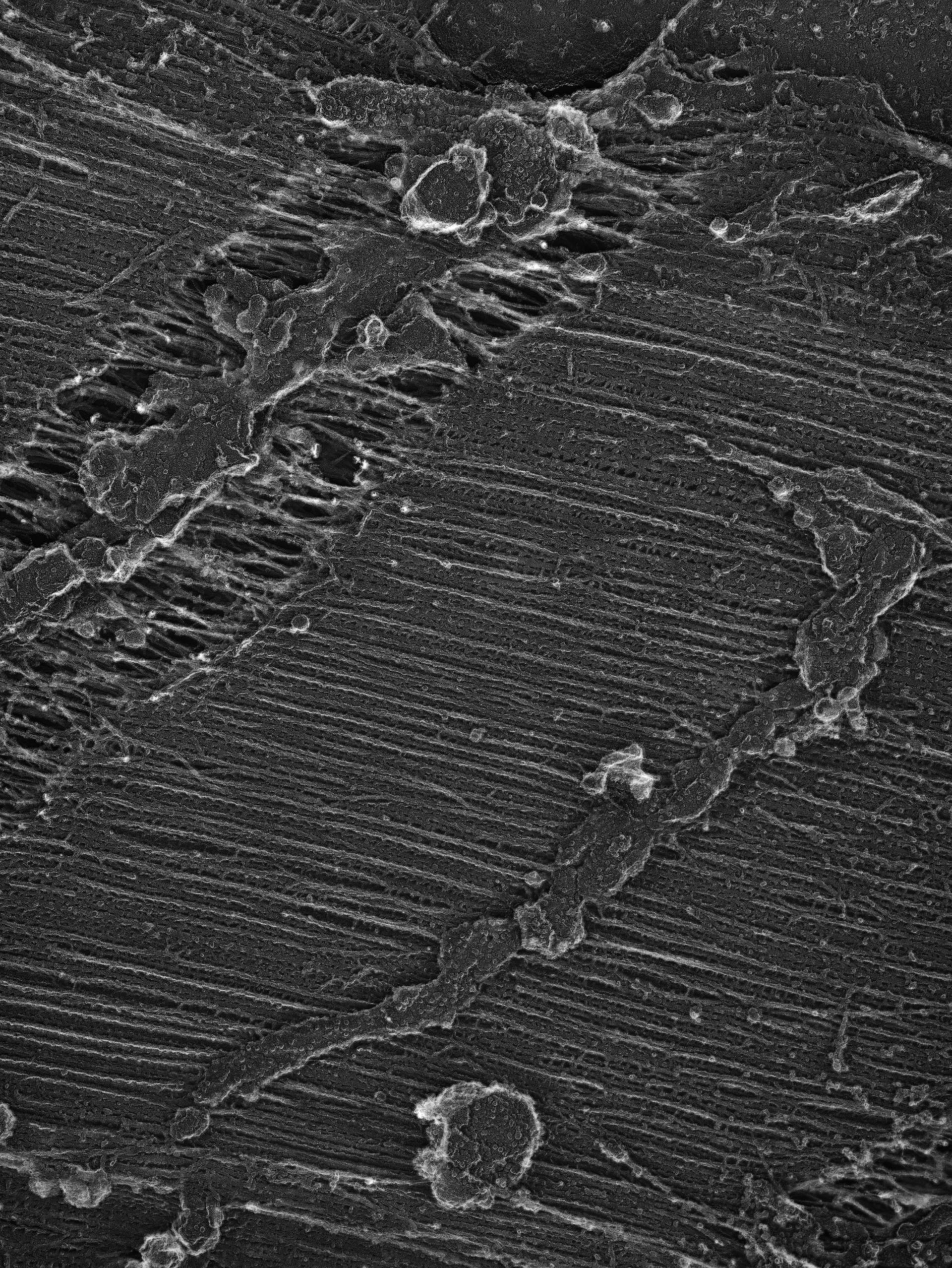 Damselfly (Sarcoplasmic reticulum) - CIL:36090