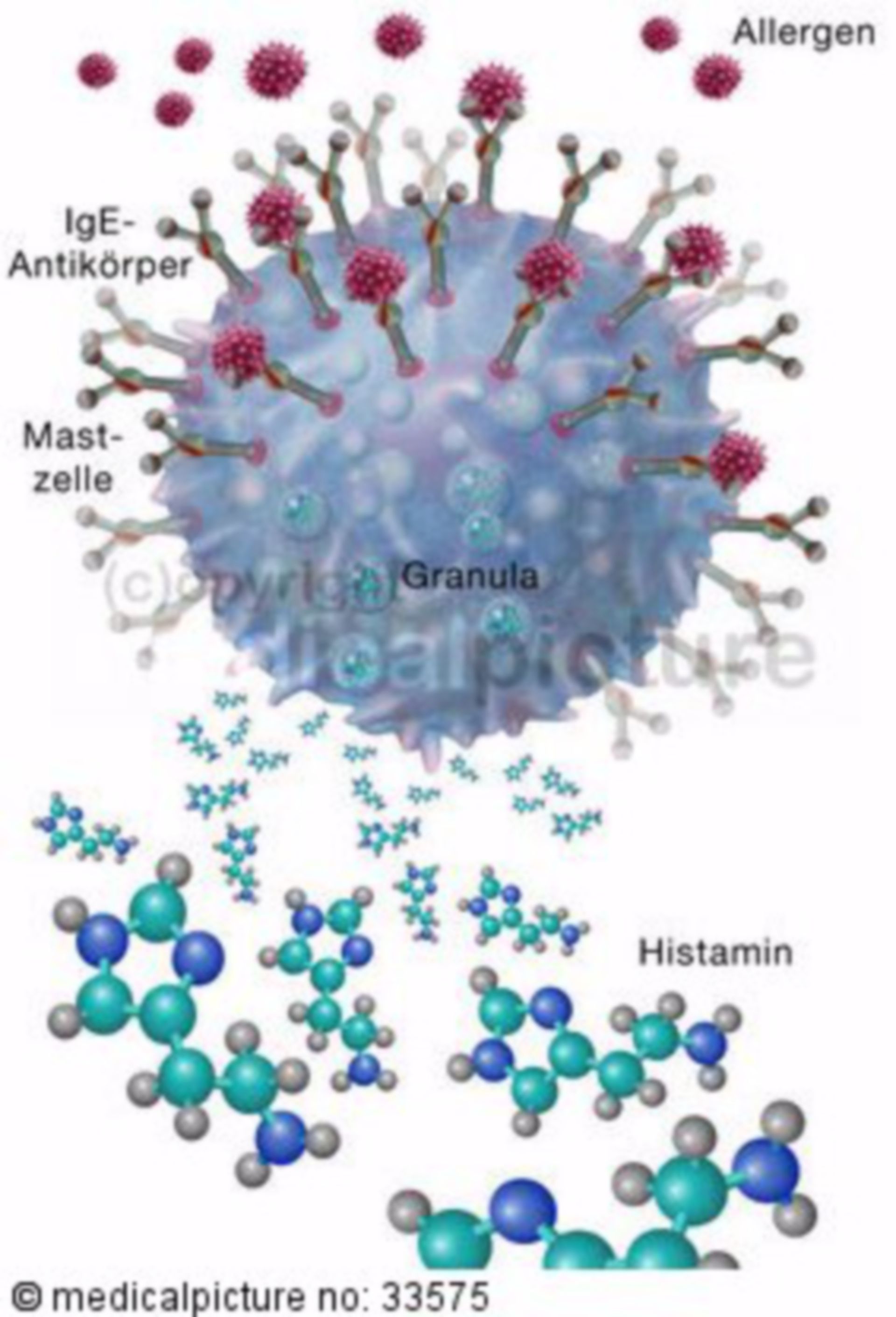  Allergische Reaktion, Histaminbildung 
