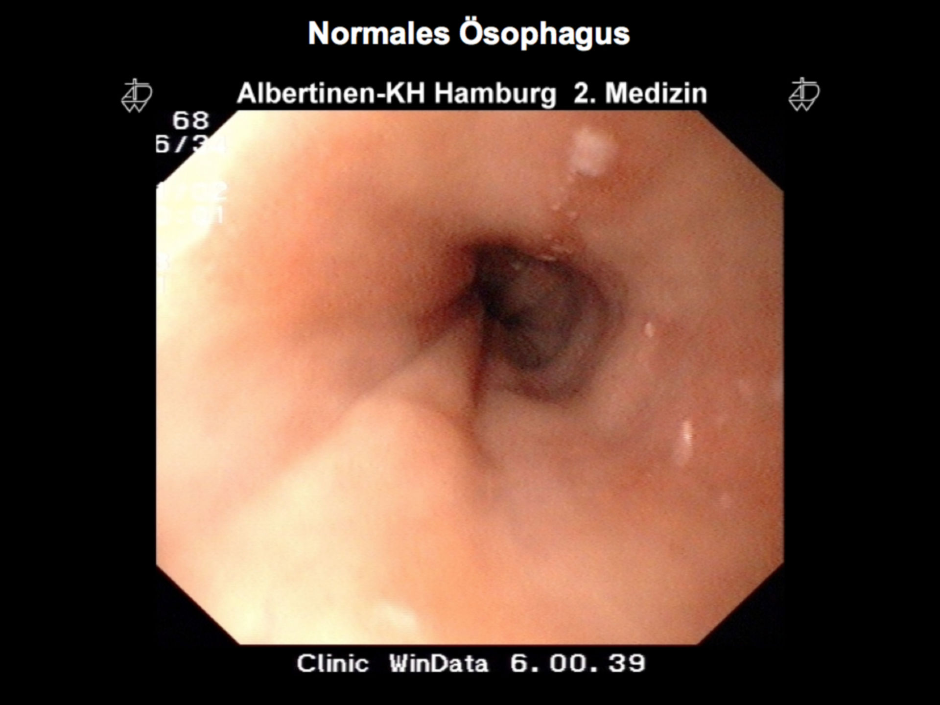 Anatomia dell'esofago