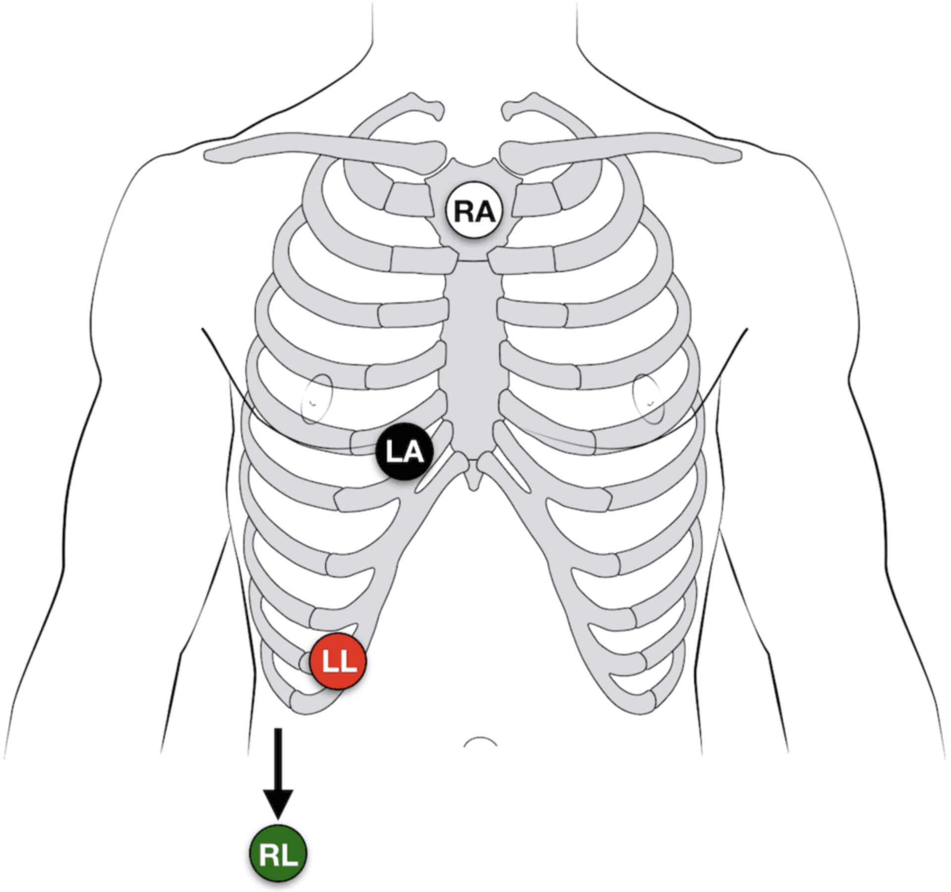 Lewis-Ableitungen - DocCheck