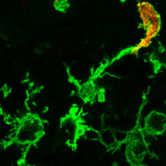 Makrophage Doccheck Flexikon