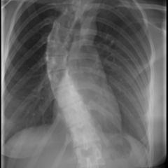 Idiopathisch DocCheck Flexikon