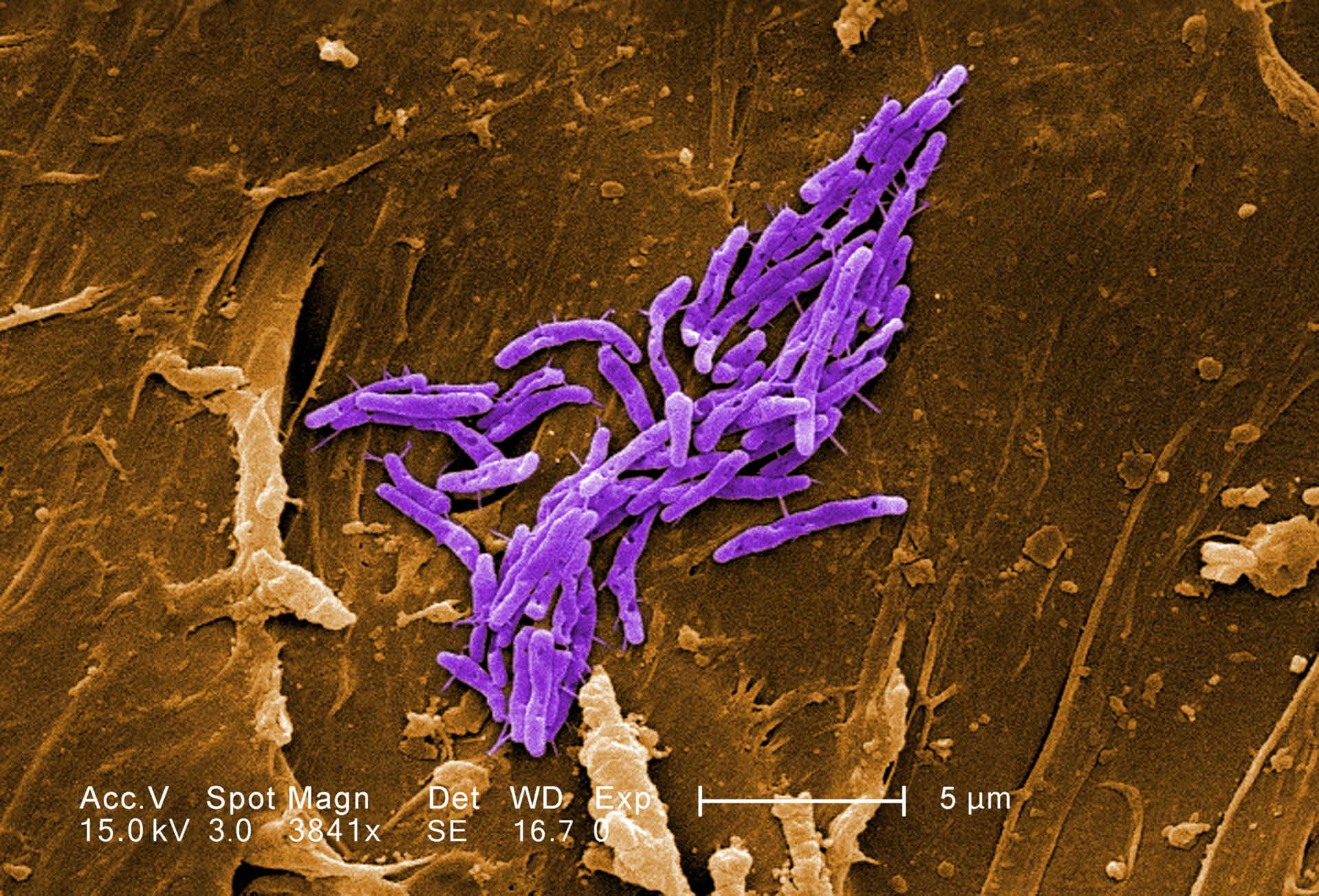 Mycobacterium fortuitum (SEM)