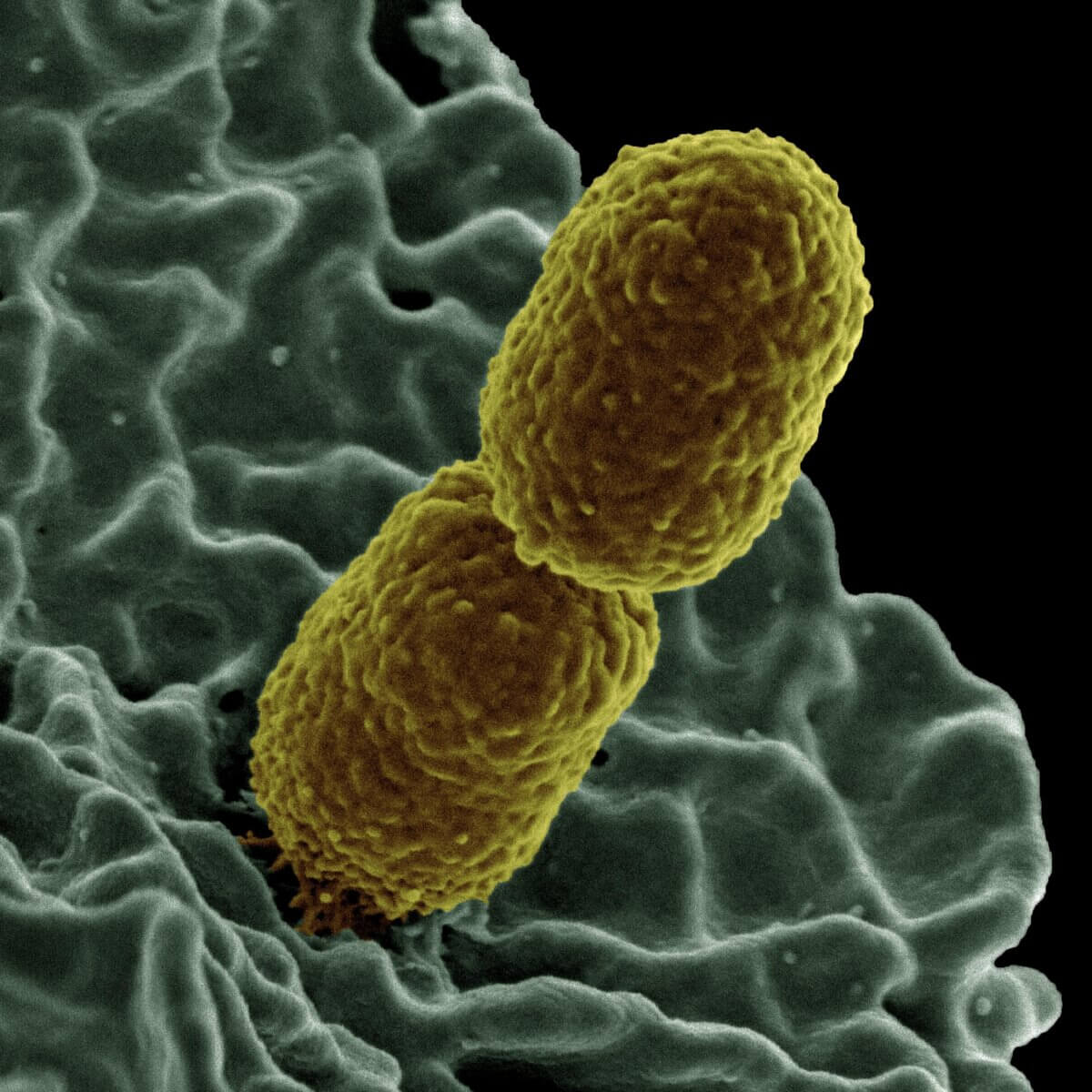 Klebsiella pneumoniae