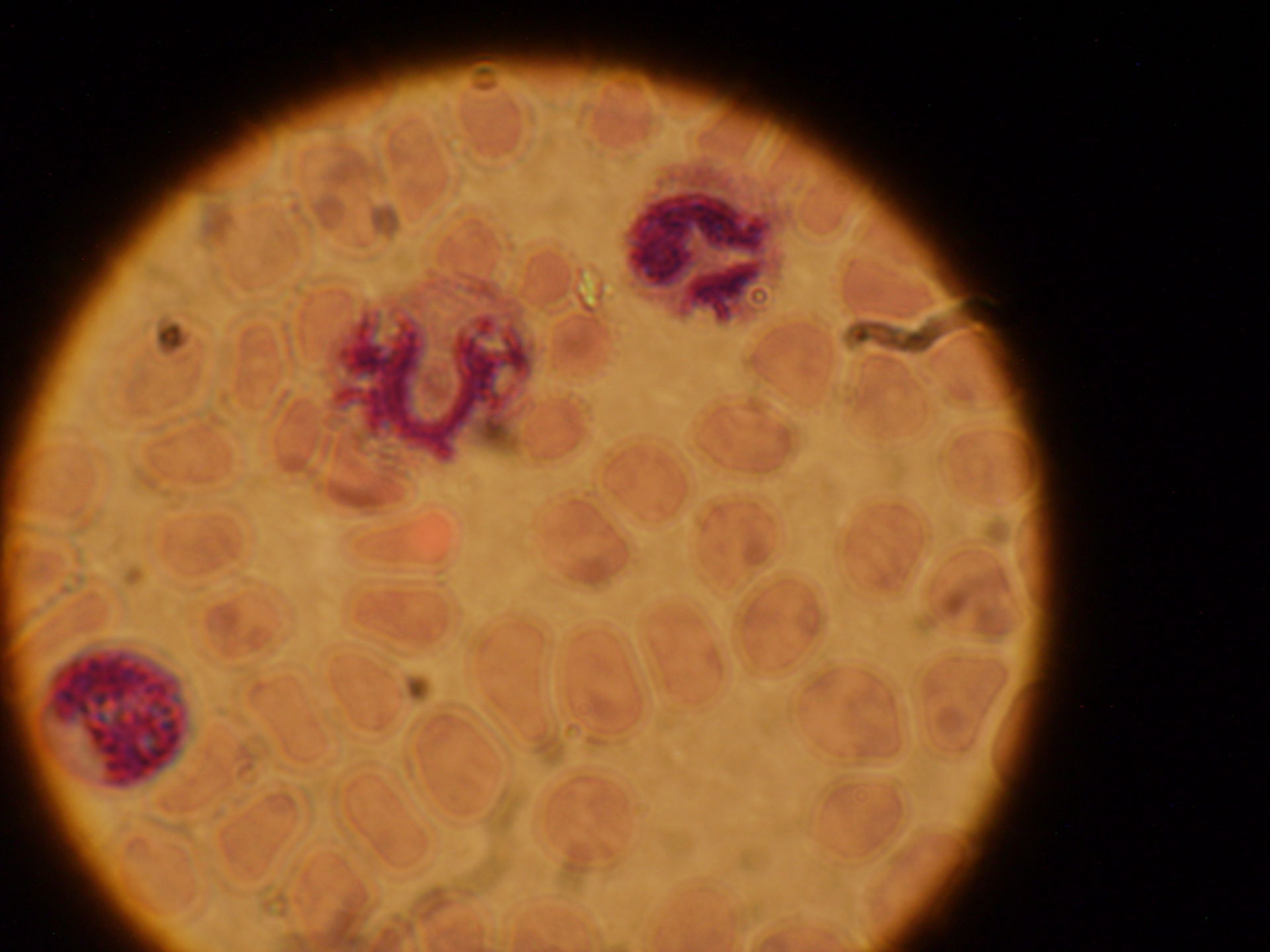 Plasmodium ovale schizonte