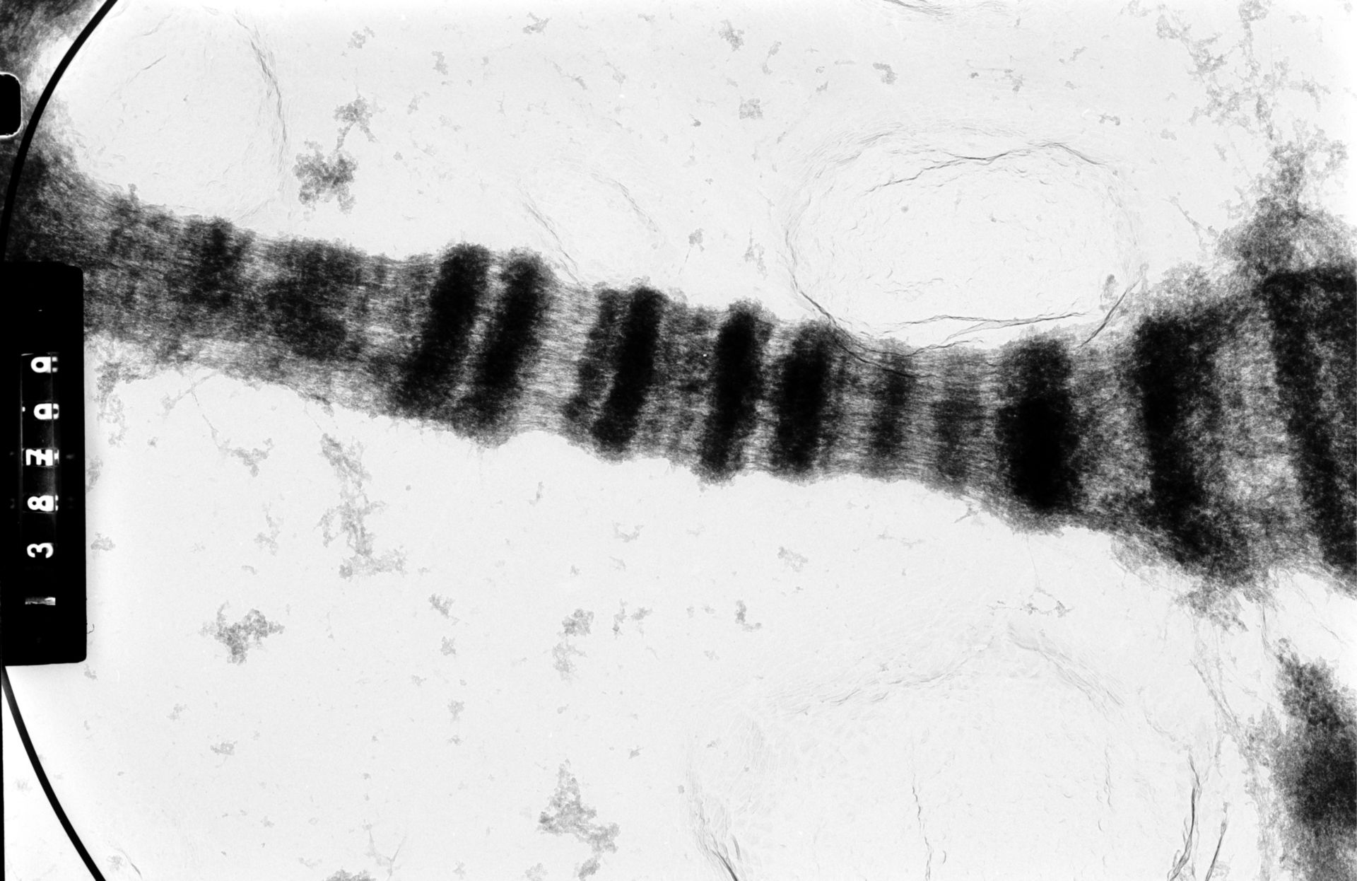 Drosophila melanocephala (Polytene chromosome) - CIL:35404