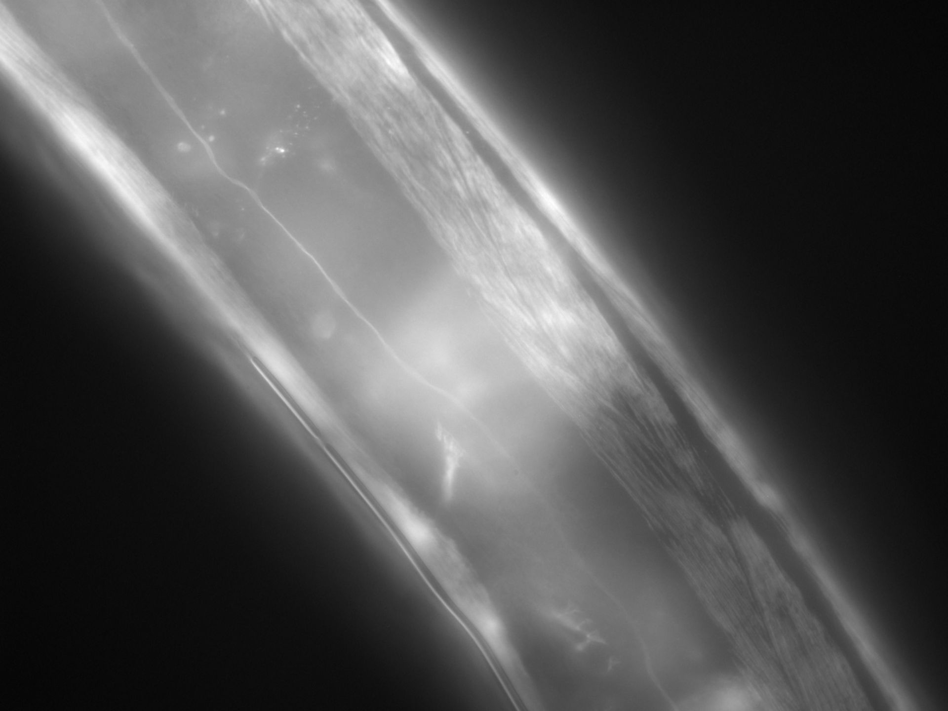 Caenorhabditis elegans (Actin filament) - CIL:1287