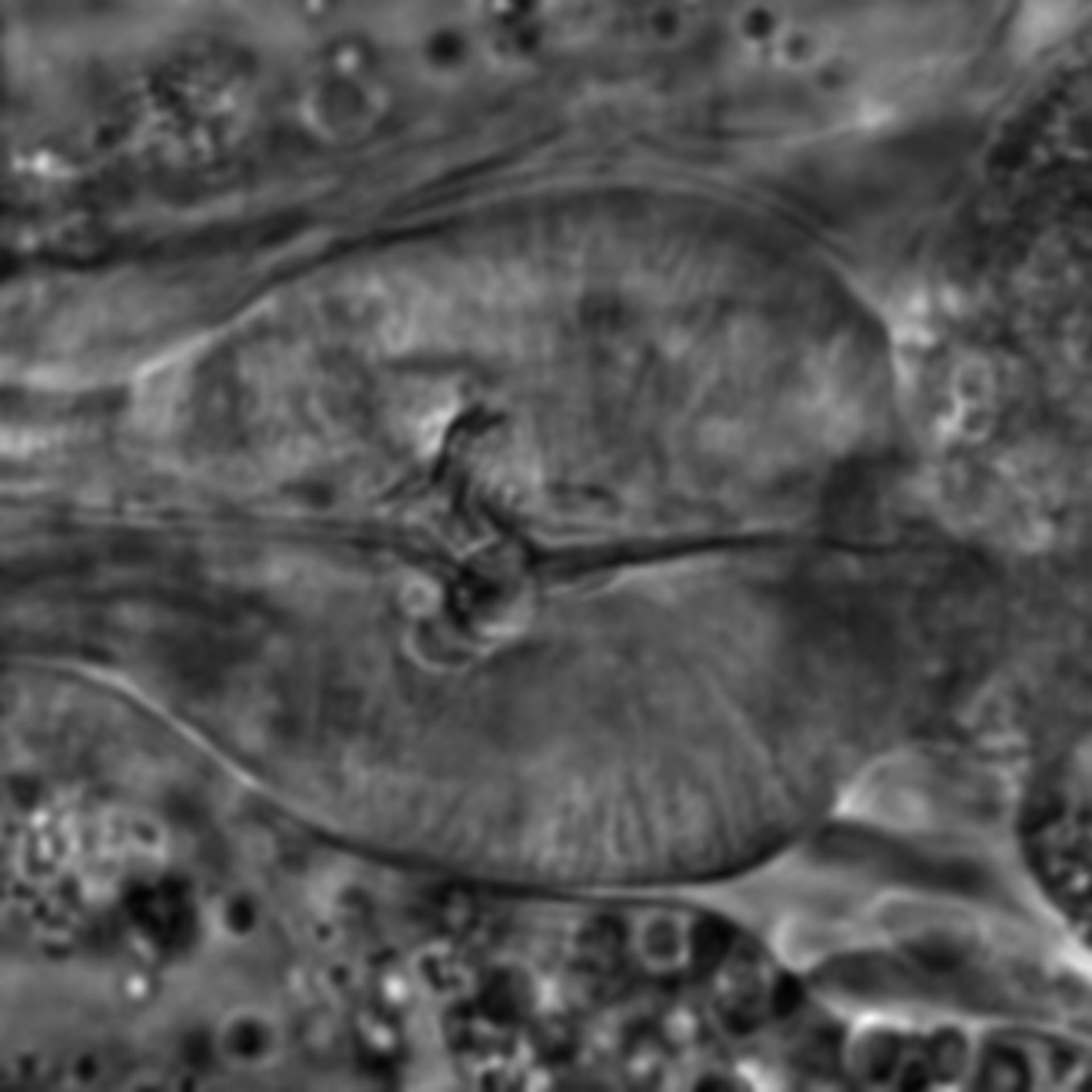 Caenorhabditis elegans - CIL:1739