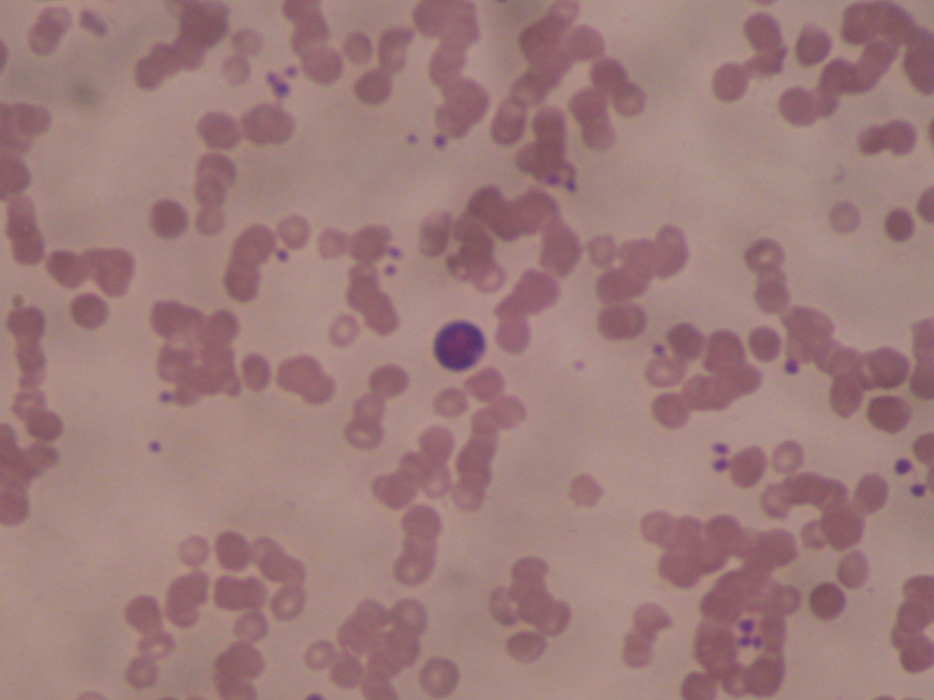 Veterinary medicine: Blood of a horse 4, lymphocytes