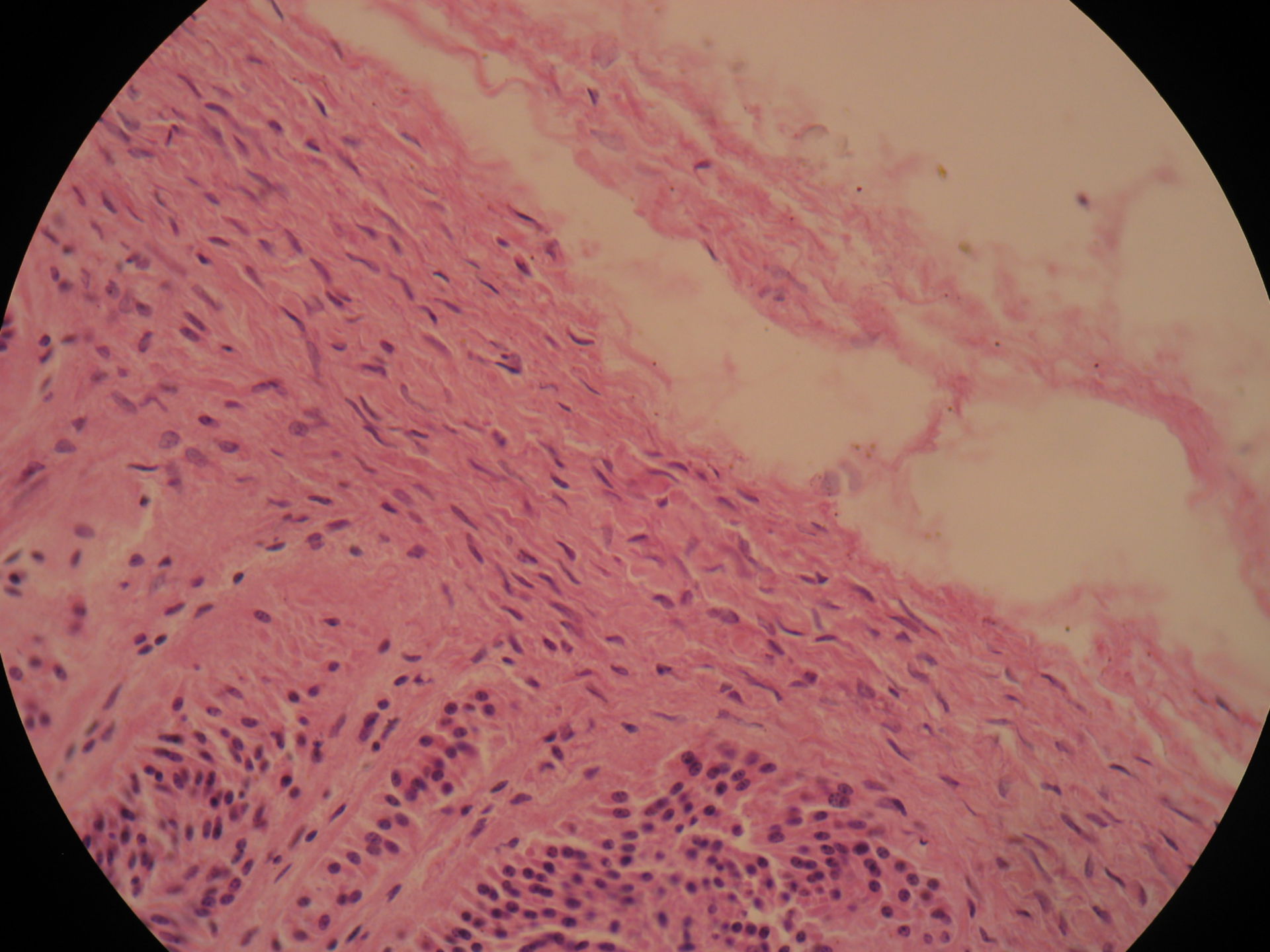 Adrenal gland of horse - fibrous capsule