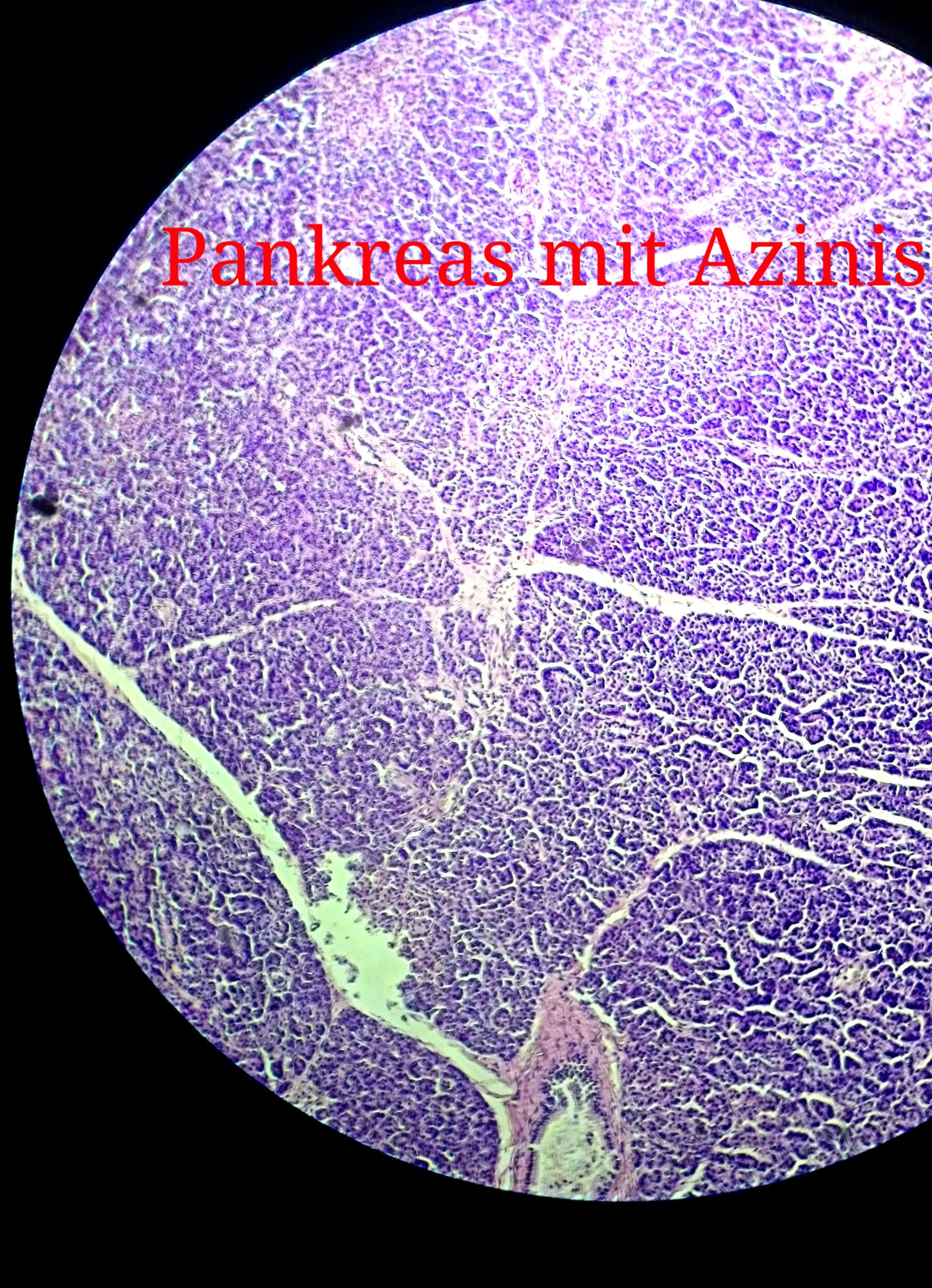 Pankreas, Azini