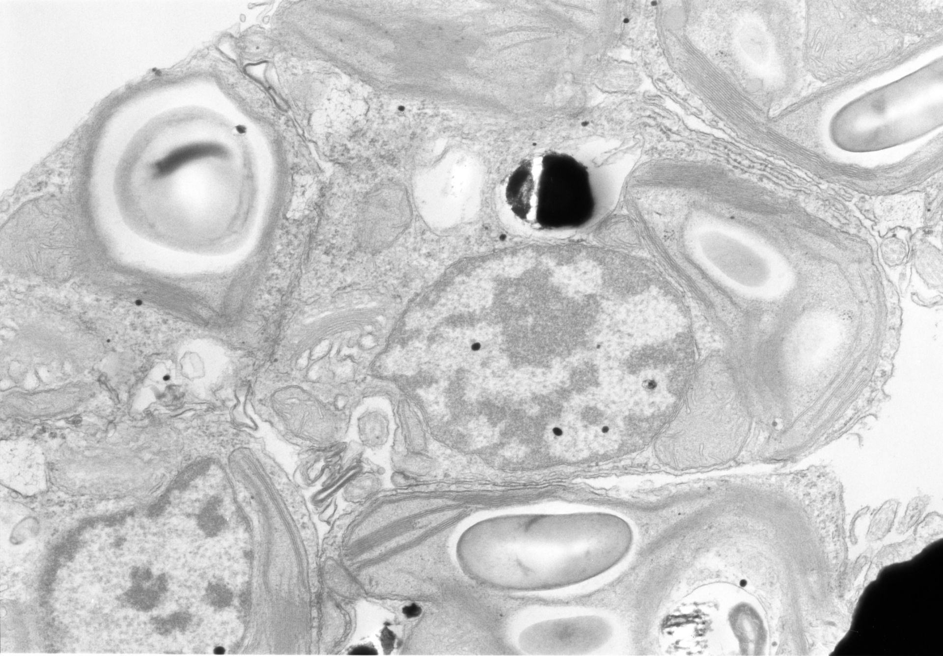 Acetabularia mediterranea (Chloroplast starch grain) - CIL:573