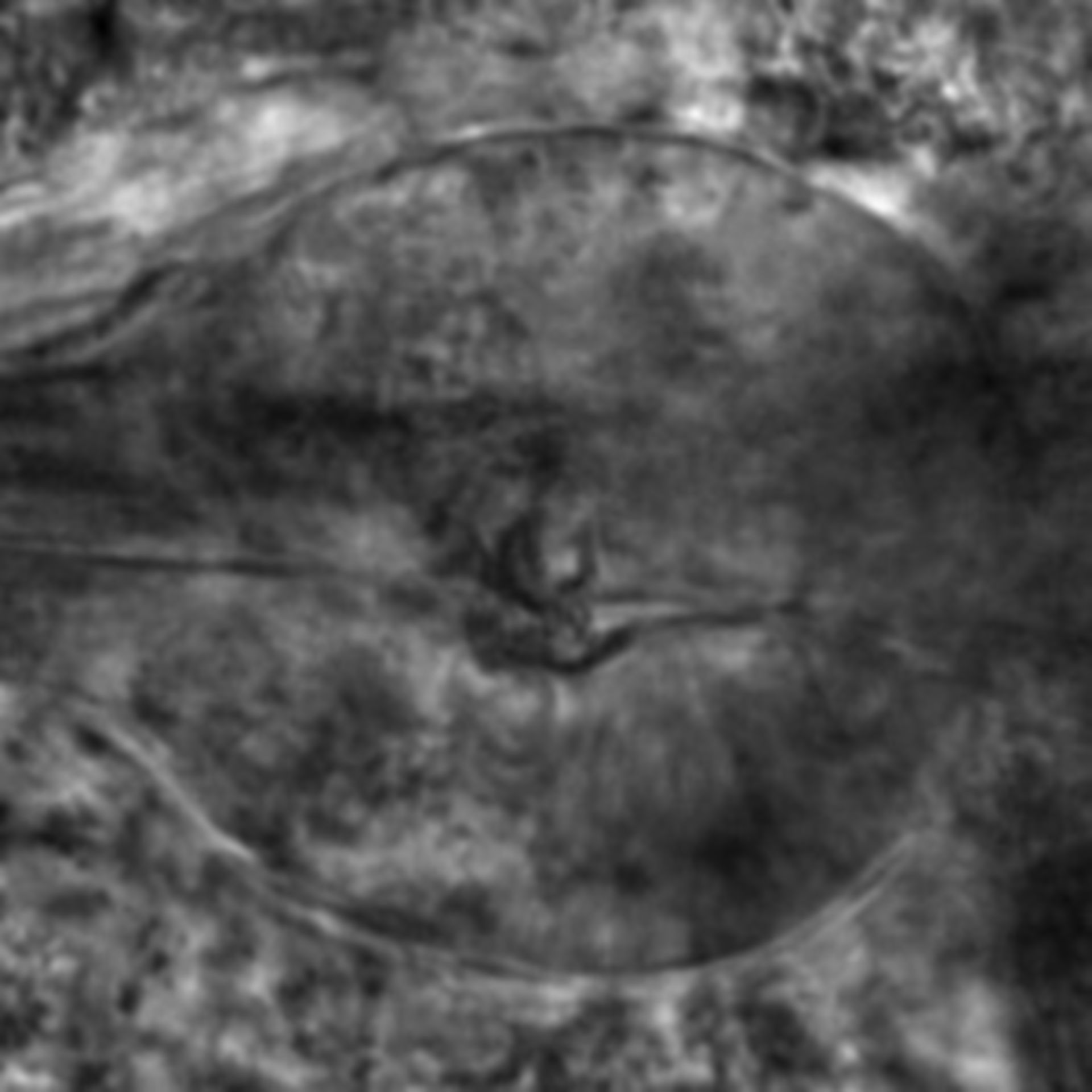 Caenorhabditis elegans - CIL:2313