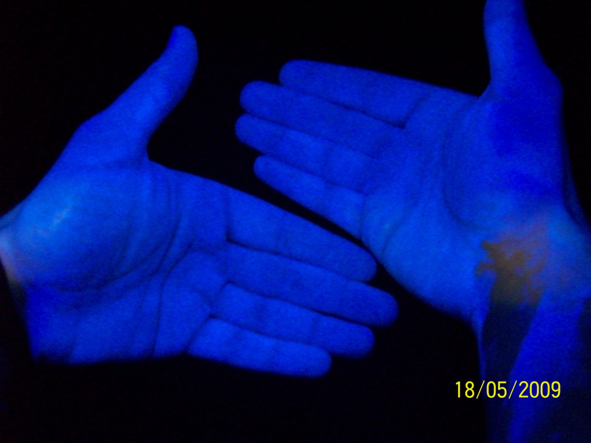 Hand disinfection with flourescent substance (3)