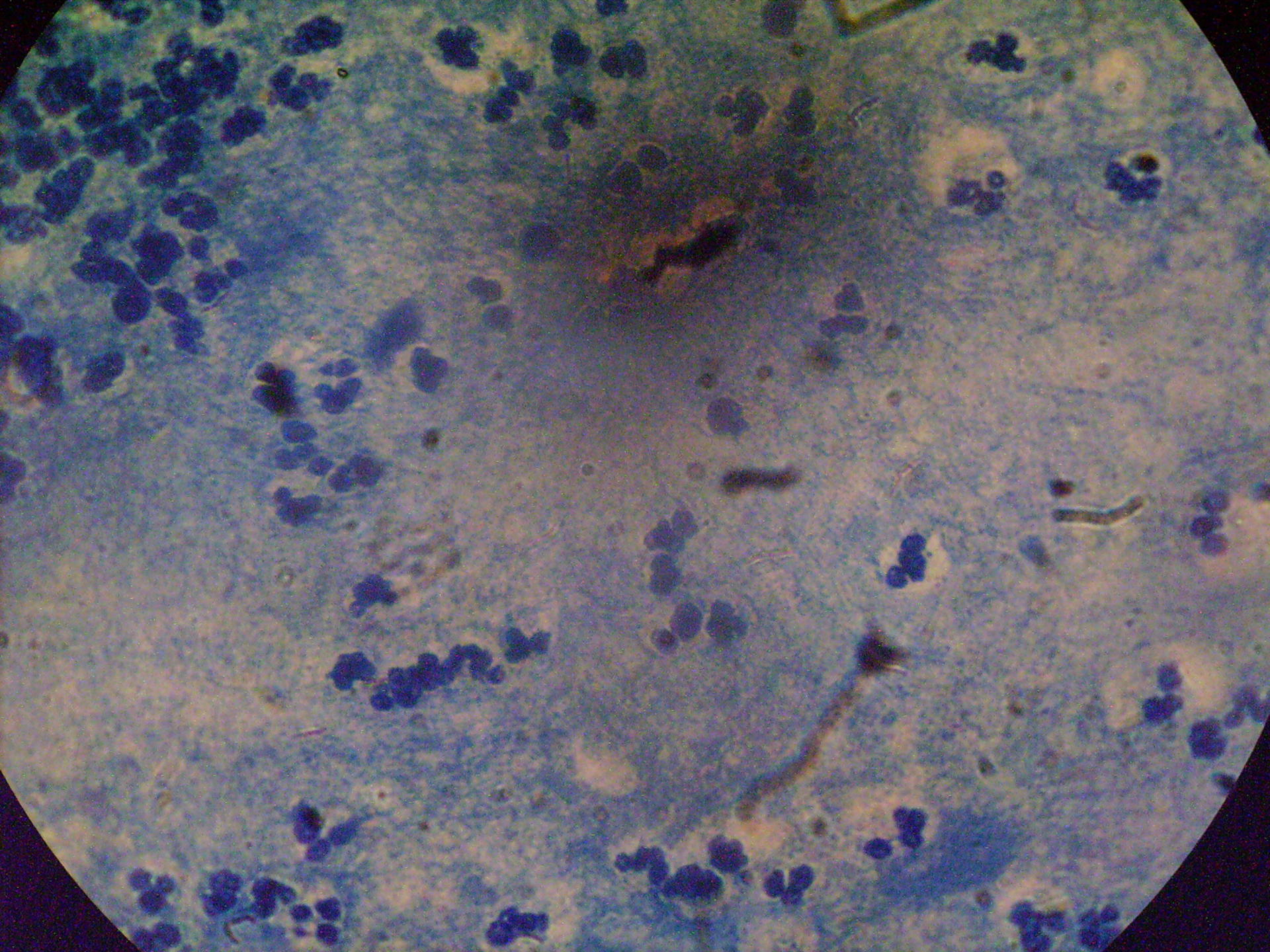 Micobatterius tubercolosis