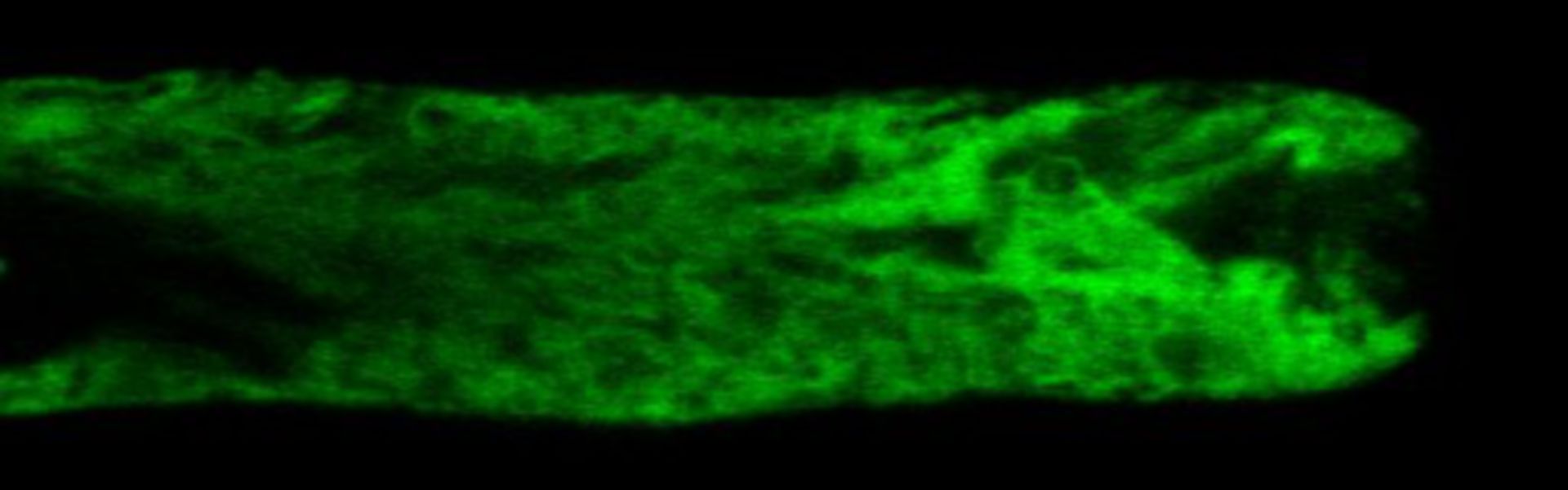 Lilium formosanum (Endoplasmic reticulum) - CIL:35289