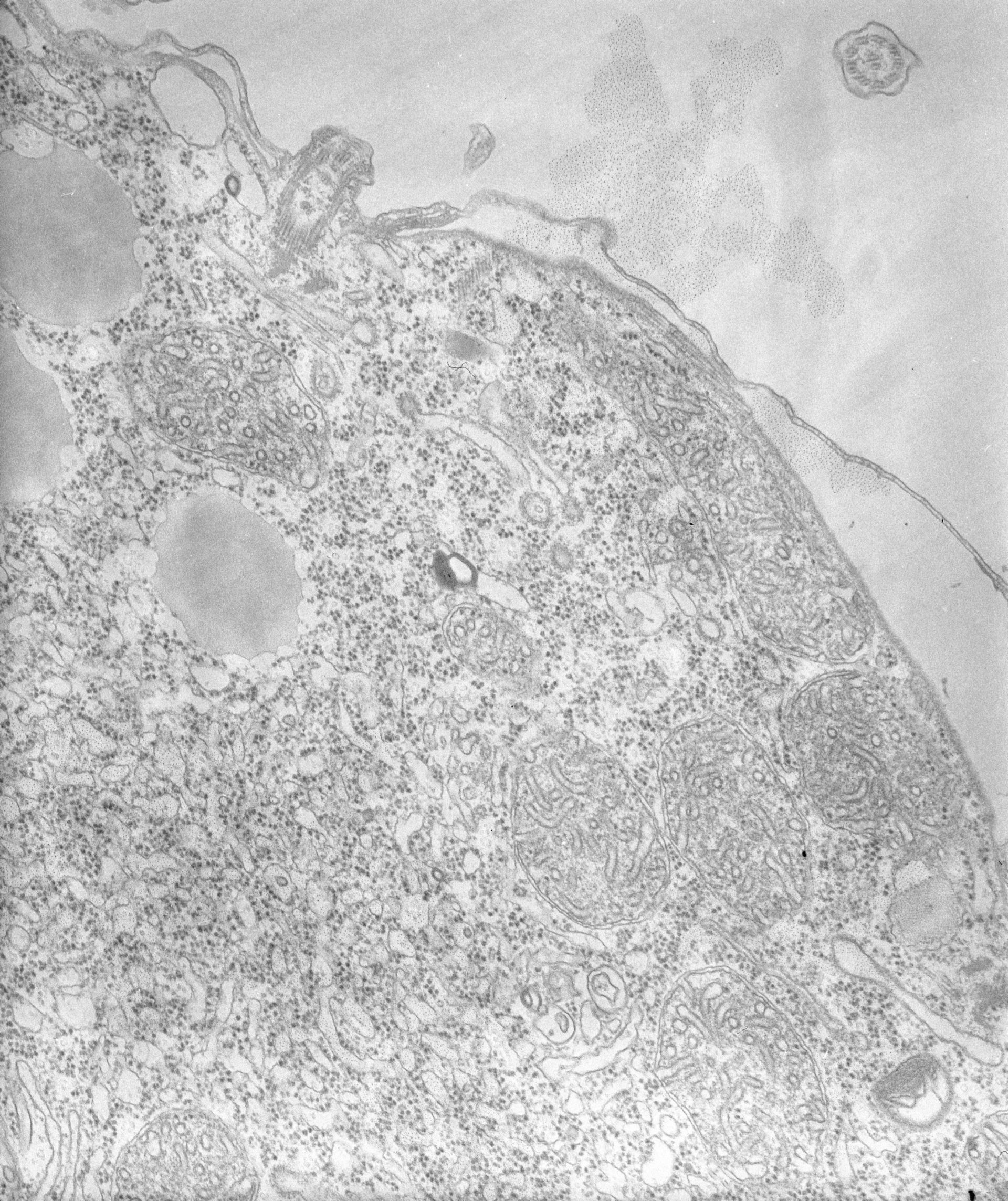 Tetrahymena pyriformis (Clathrin coat of coated pit) - CIL:34743