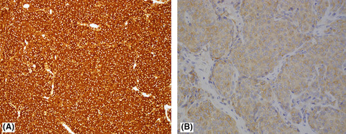 ccr34435-fig-0004-m_original.jpg