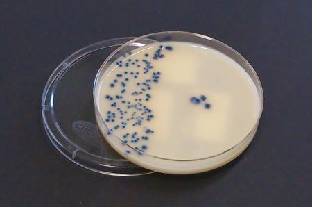 Carbapenemase-produzierende Enterobakterien (blau gefärbt) auf einer Agarplatte. © Institut für Medizinische Mikrobiologie der JLU Gießen / Judith Schmiedel