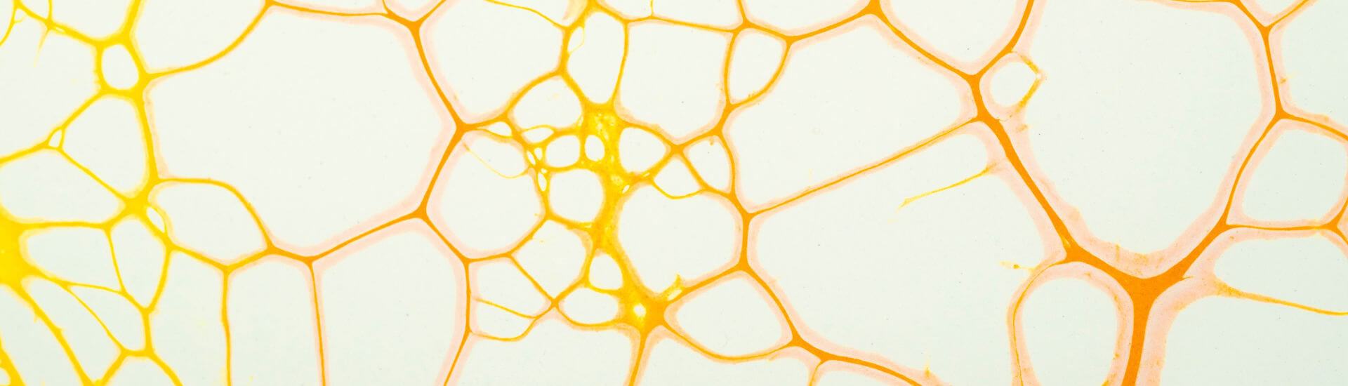 Lungenkrebs: Finger weg von Cholesterinsenkern - DocCheck