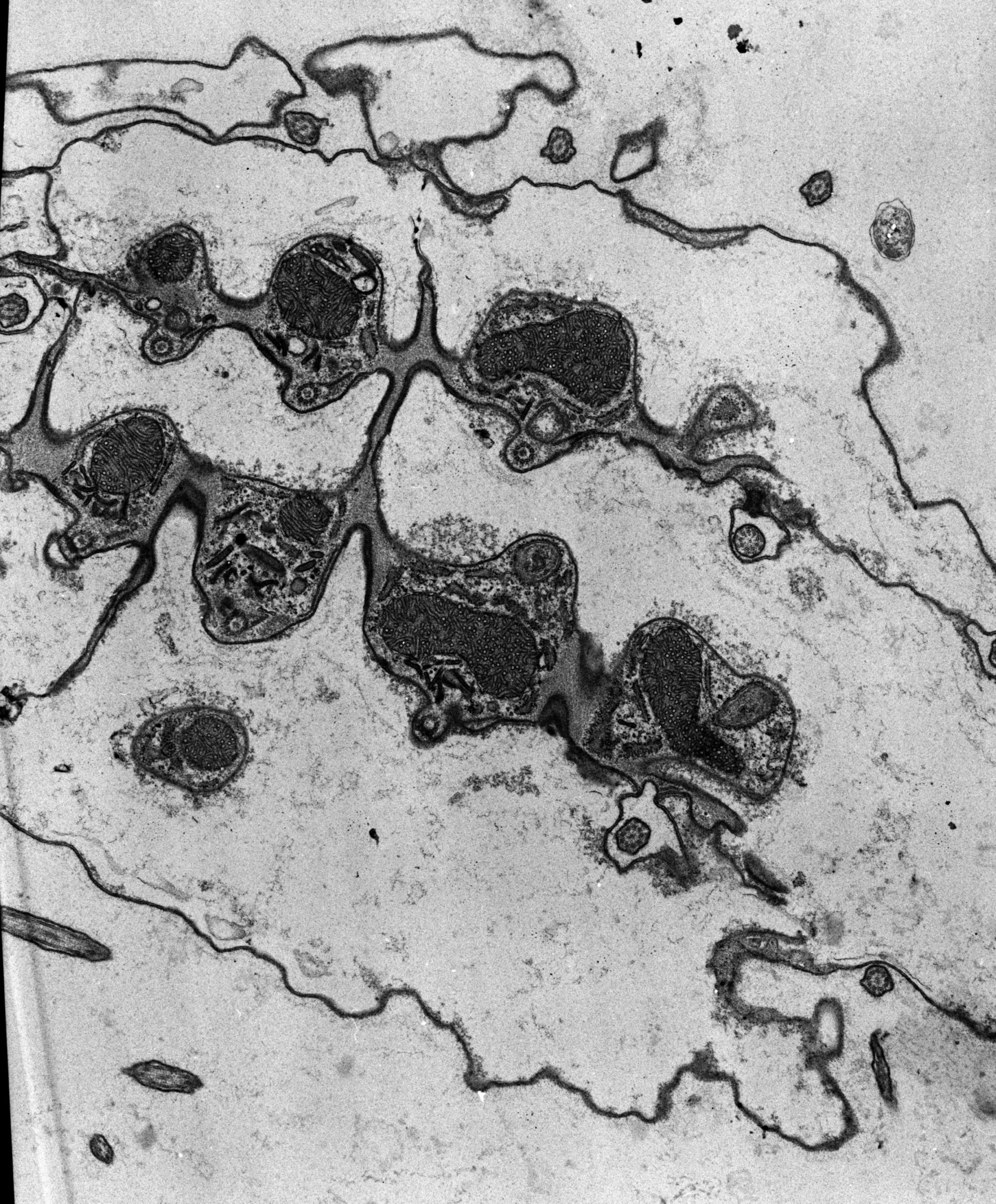 Coleps hirtus (Cilium) - CIL:38827