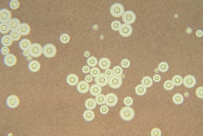 low-res_cryptococcus_neoformans.jpg_original.jpg