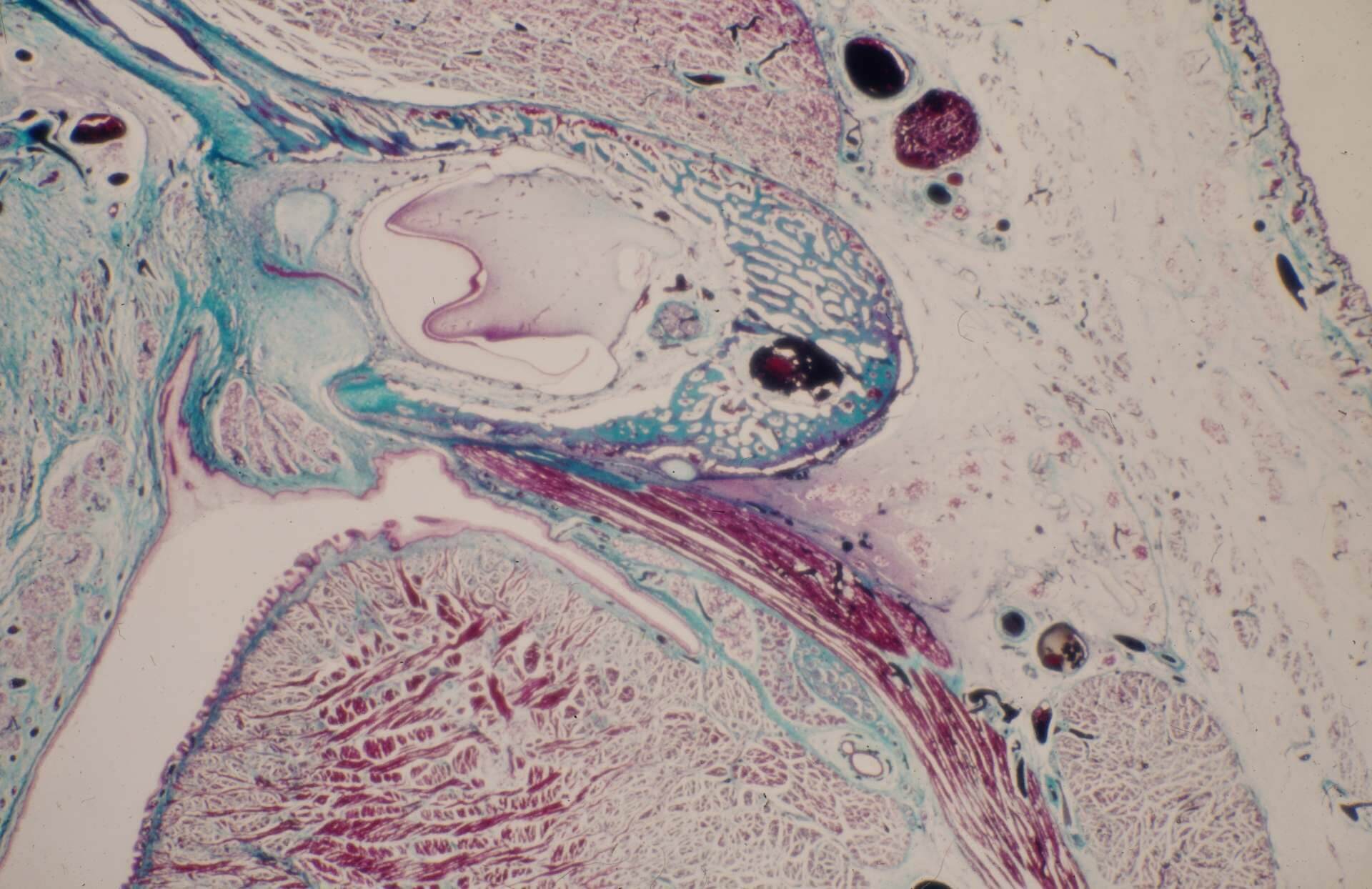 Histologiepräparat Zahnkeim