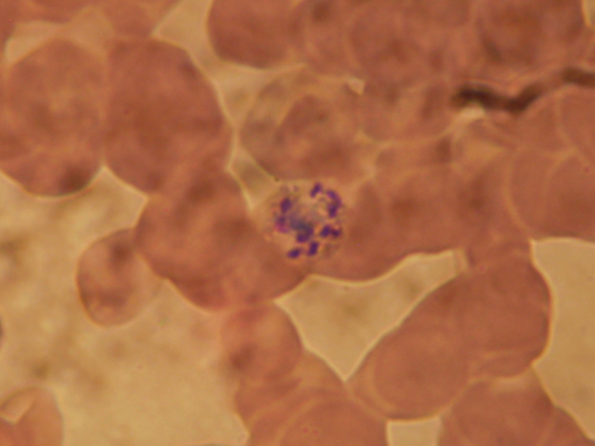 Plasmodium malariae schizont