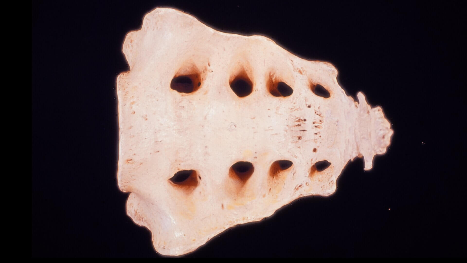 Os sacrum und Os coccygis