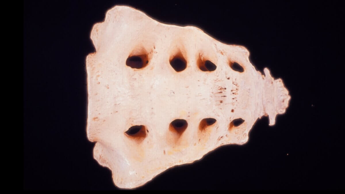 Os sacrum und Os coccygis