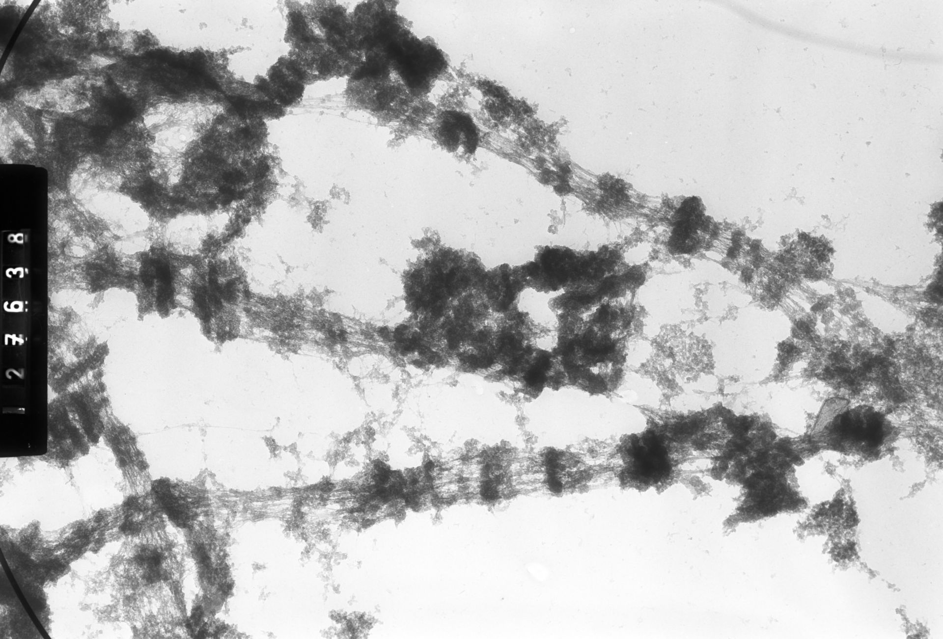 Drosophila melanogaster (Polytene chromosome) - CIL:25386