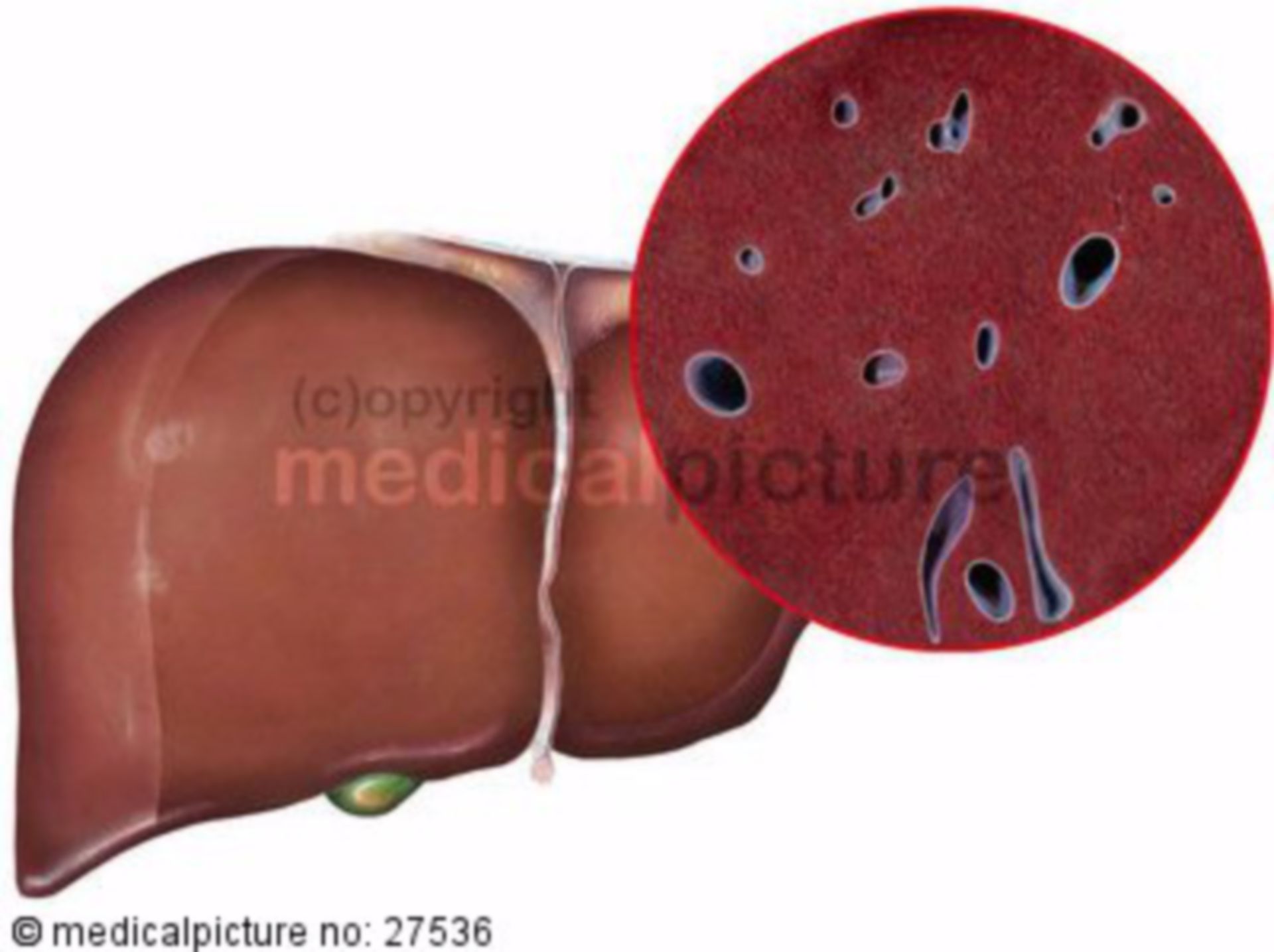  Leber, Organ und histologisch 
