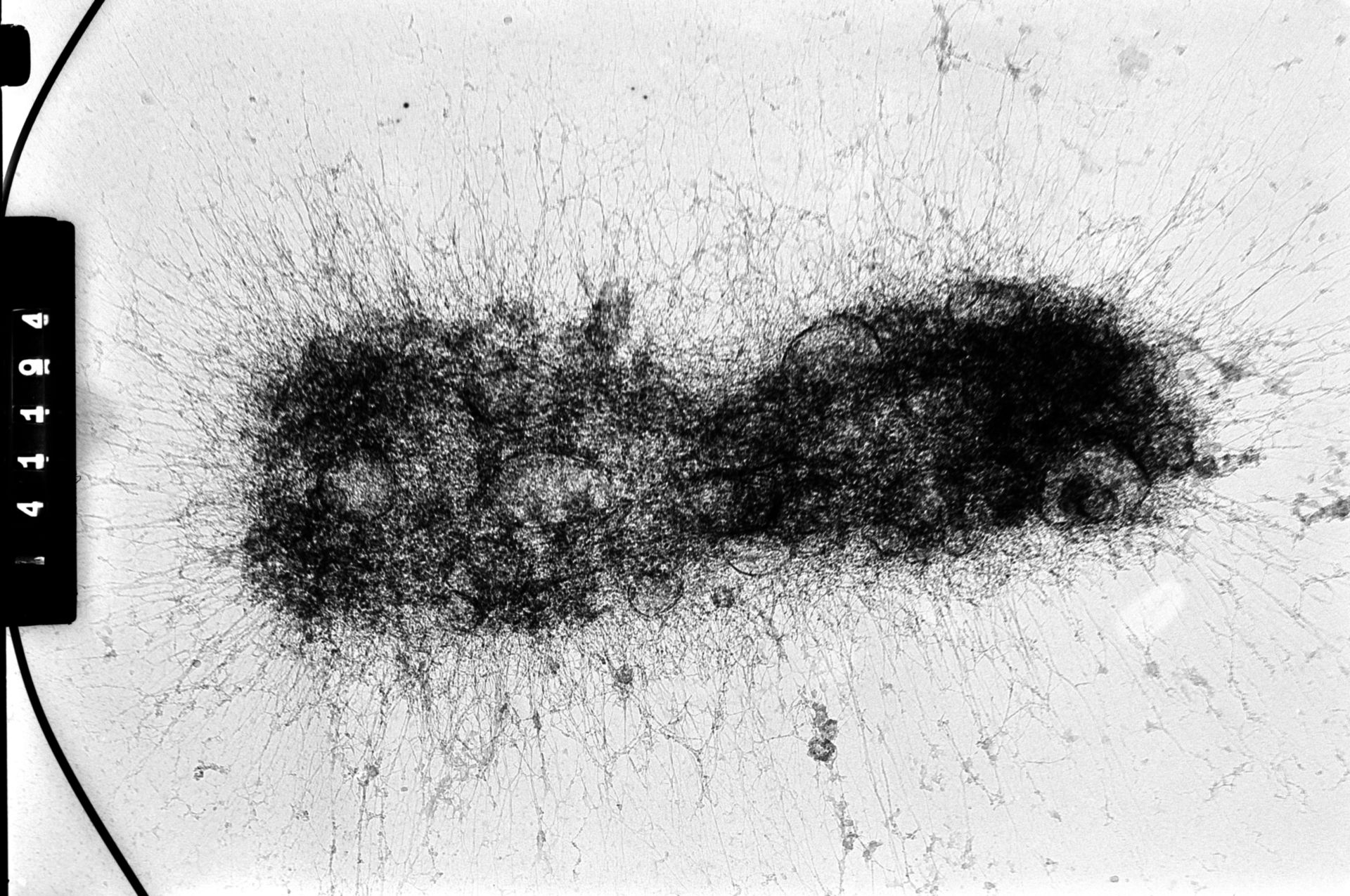 Homo sapiens (Condensed chromosome) - CIL:35384